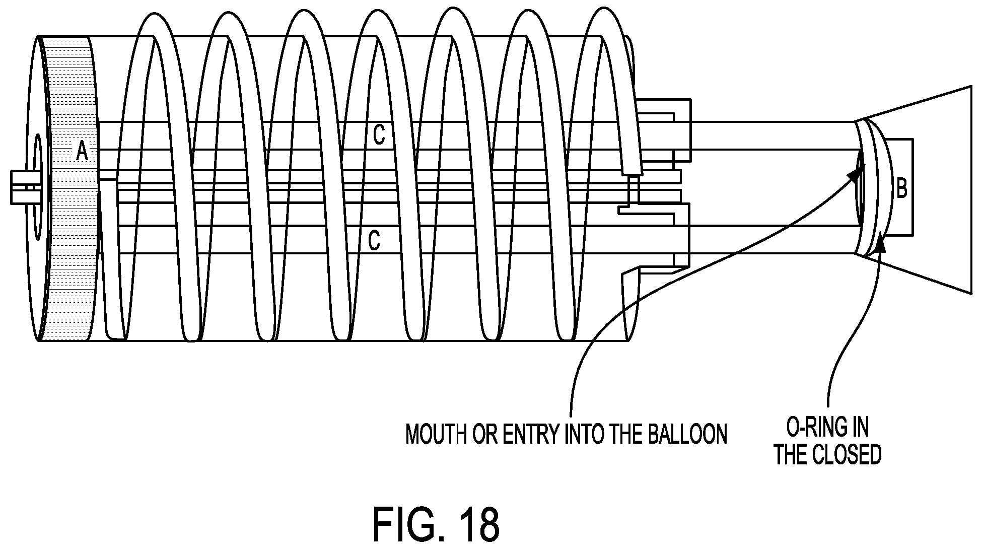 Patent US12167976 Figure 20 – Check valve with docking station for gastrointestinal balloon