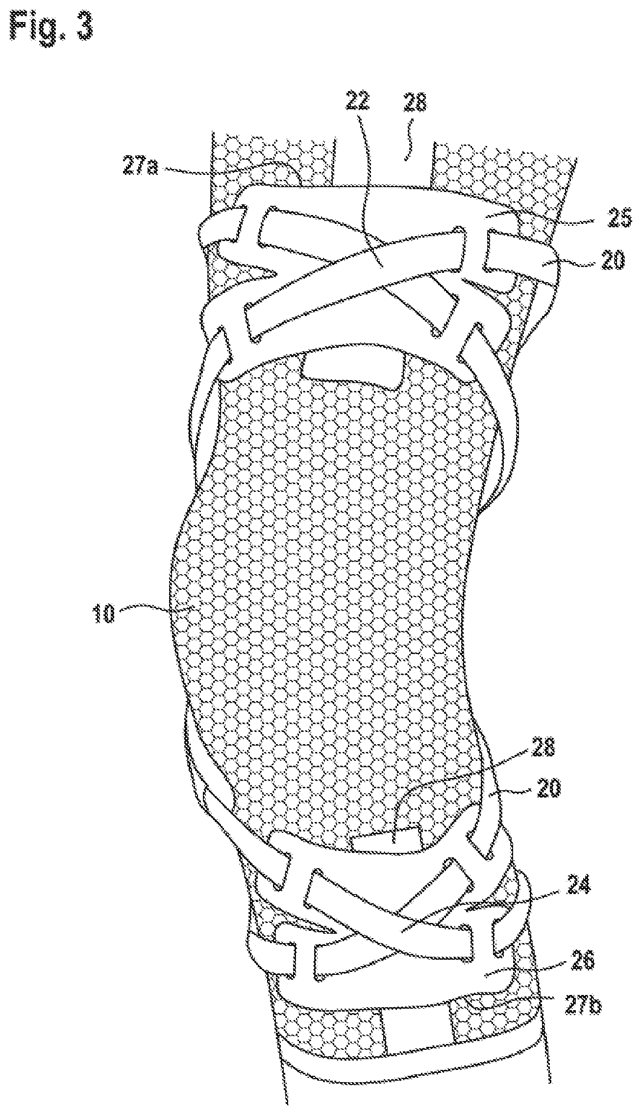 Patent US12167977 Figure 4 – Limb orthosis, in particular knee brace