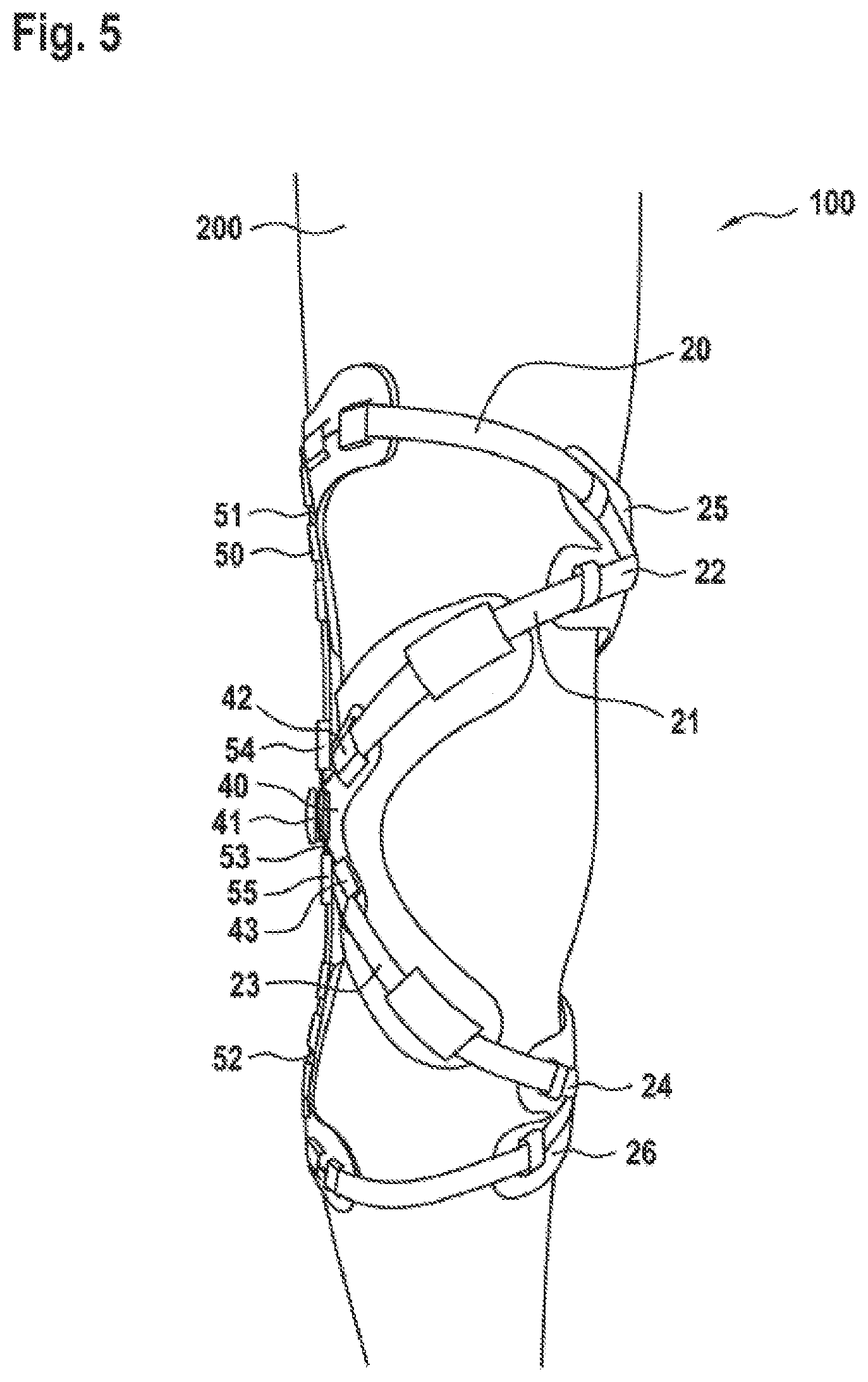 Patent US12167977 Figure 6 – Limb orthosis, in particular knee brace