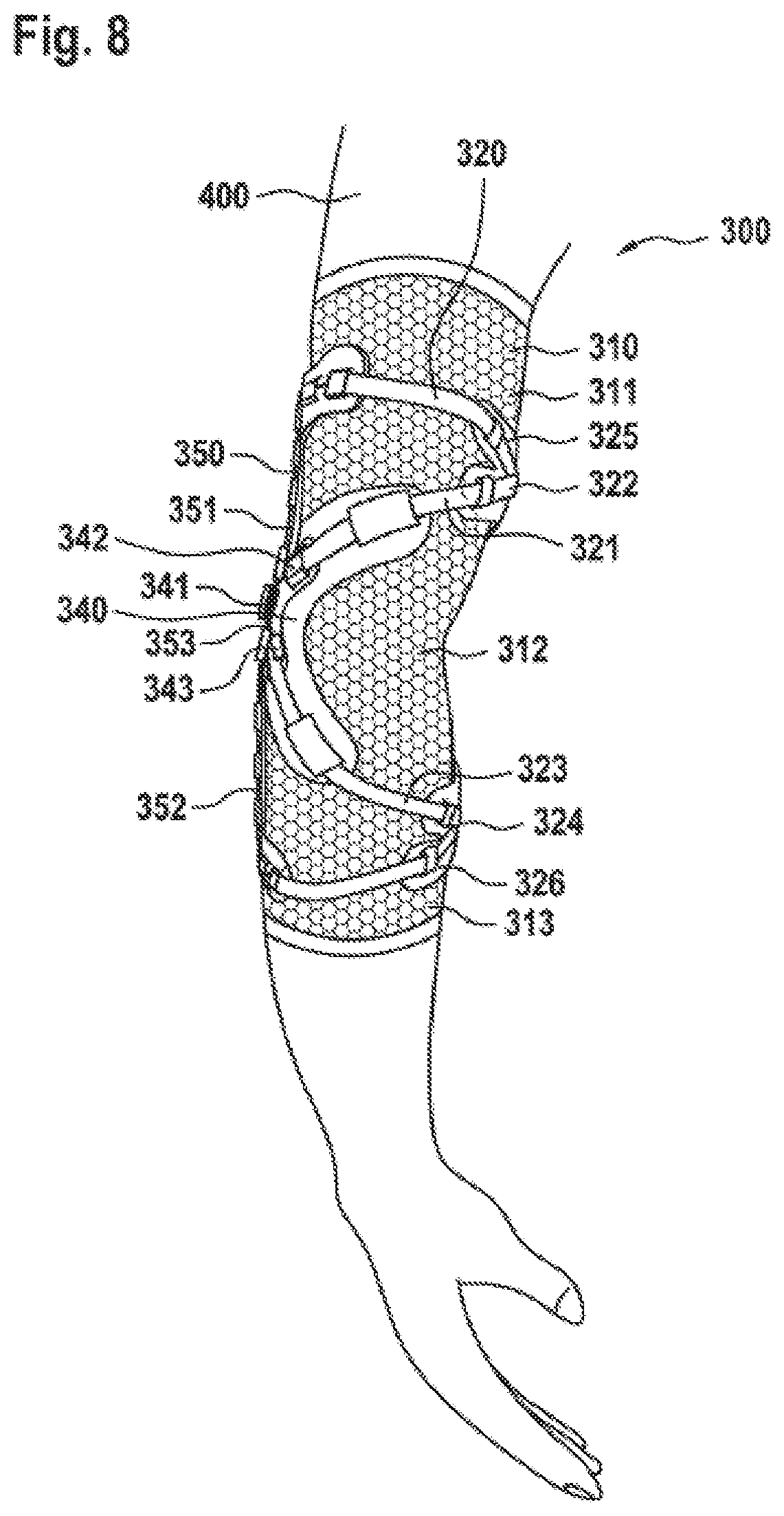 Patent US12167977 Figure 9 – Limb orthosis, in particular knee brace