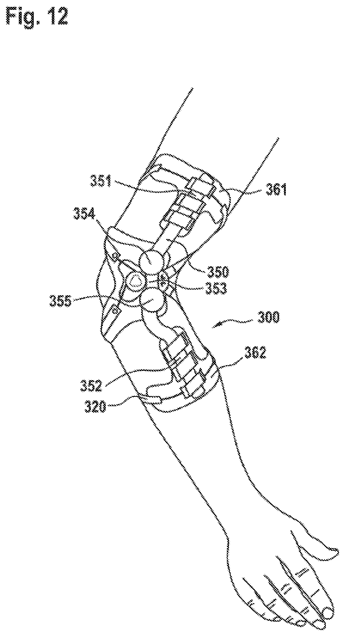 Patent US12167977 Figure 13 – Limb orthosis, in particular knee brace