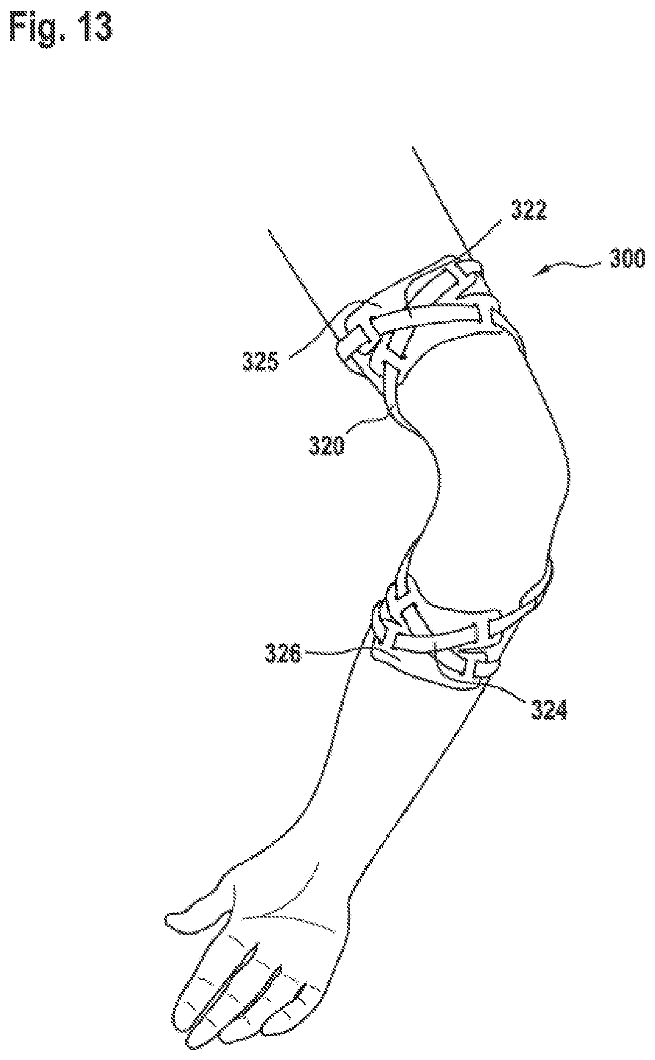 Patent US12167977 Figure 14 – Limb orthosis, in particular knee brace