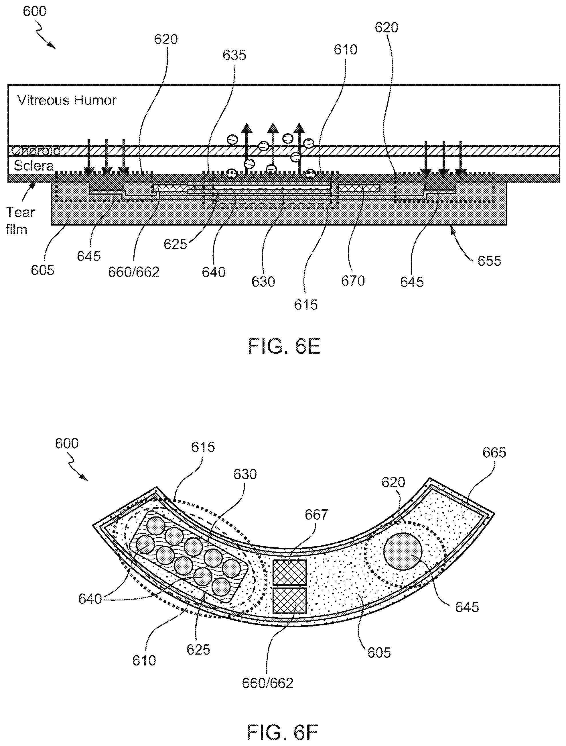 Patent US12167978 Figure 11 – Eye mounted device for therapeutic agent release