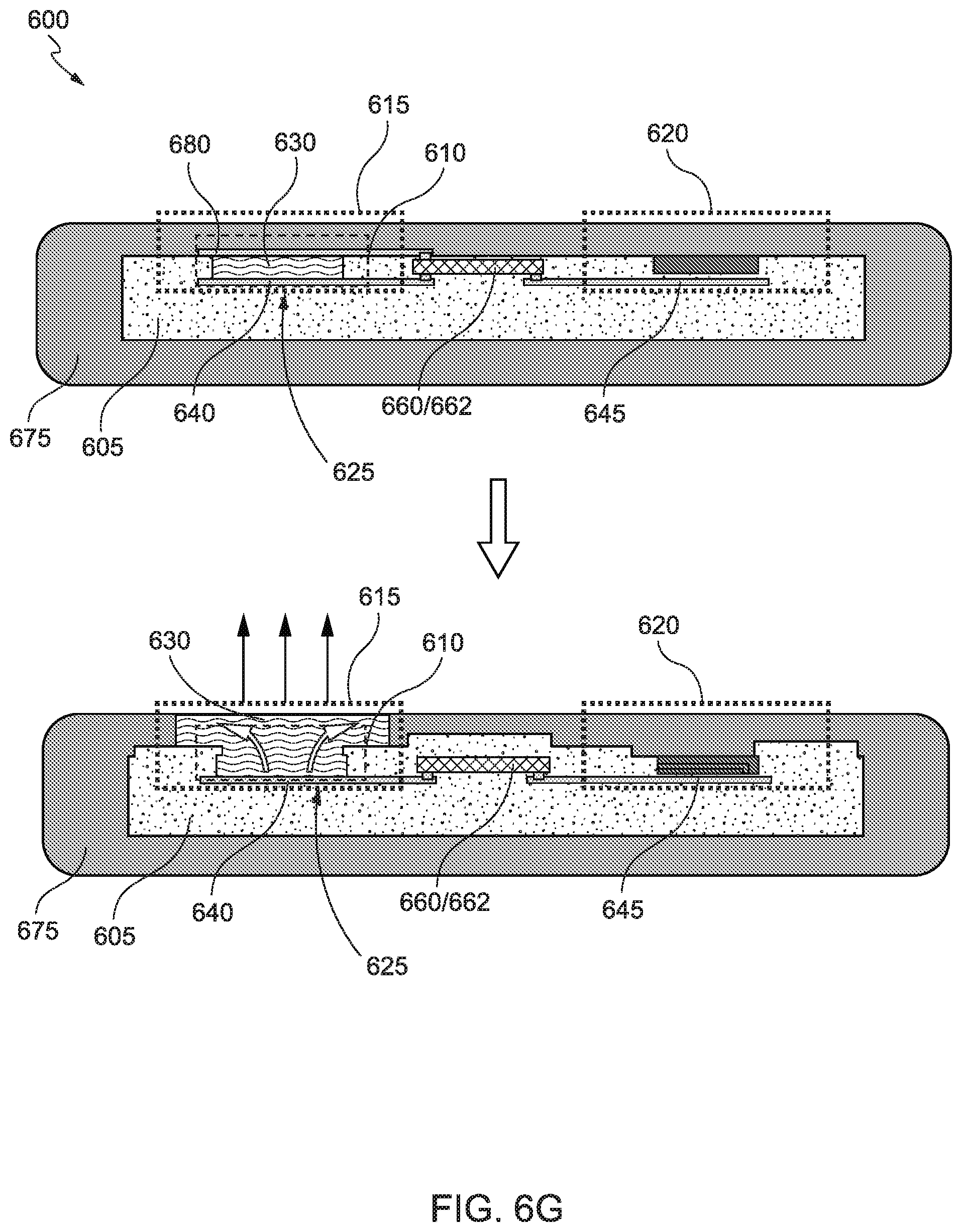 Patent US12167978 Figure 12 – Eye mounted device for therapeutic agent release