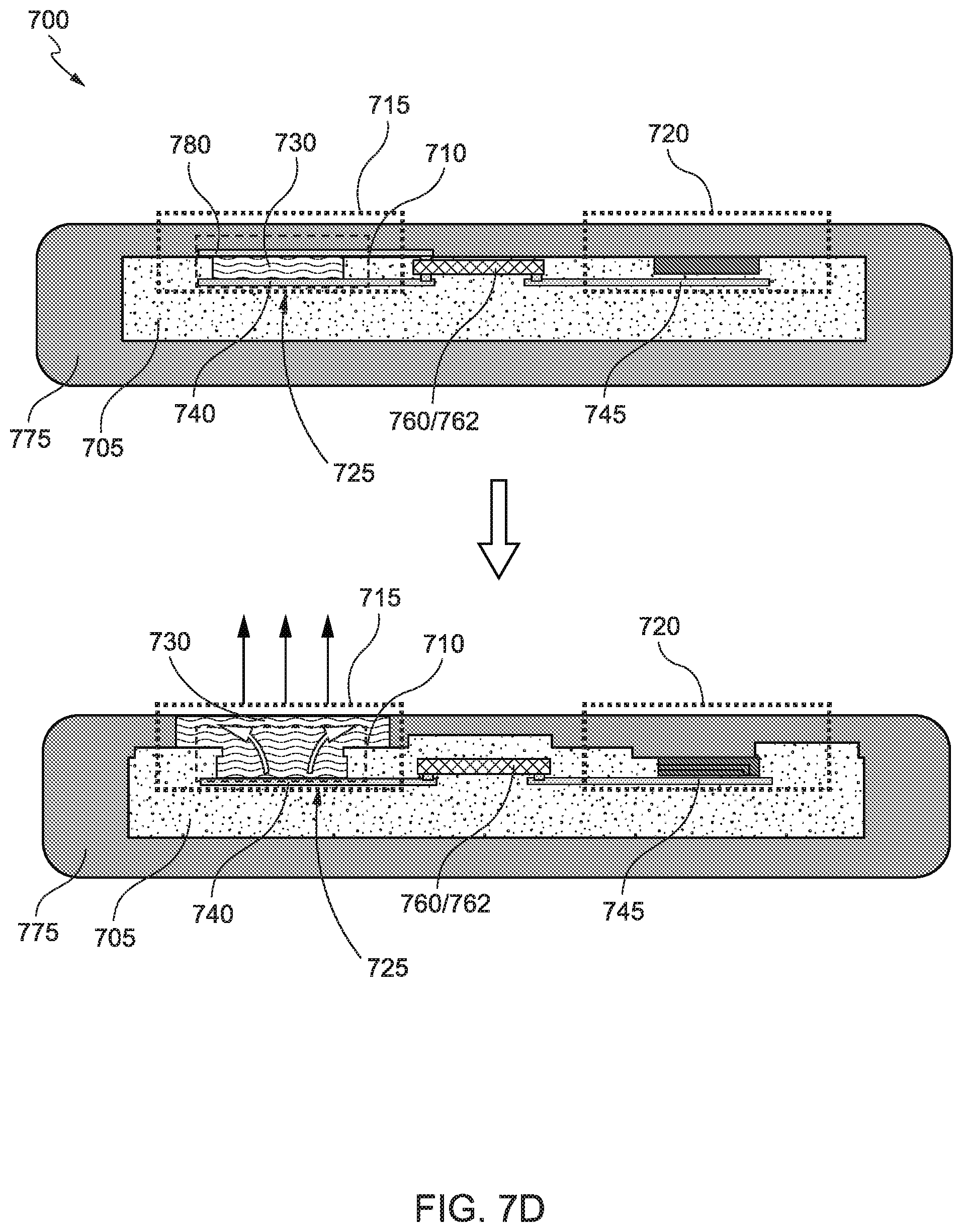 Patent US12167978 Figure 15 – Eye mounted device for therapeutic agent release