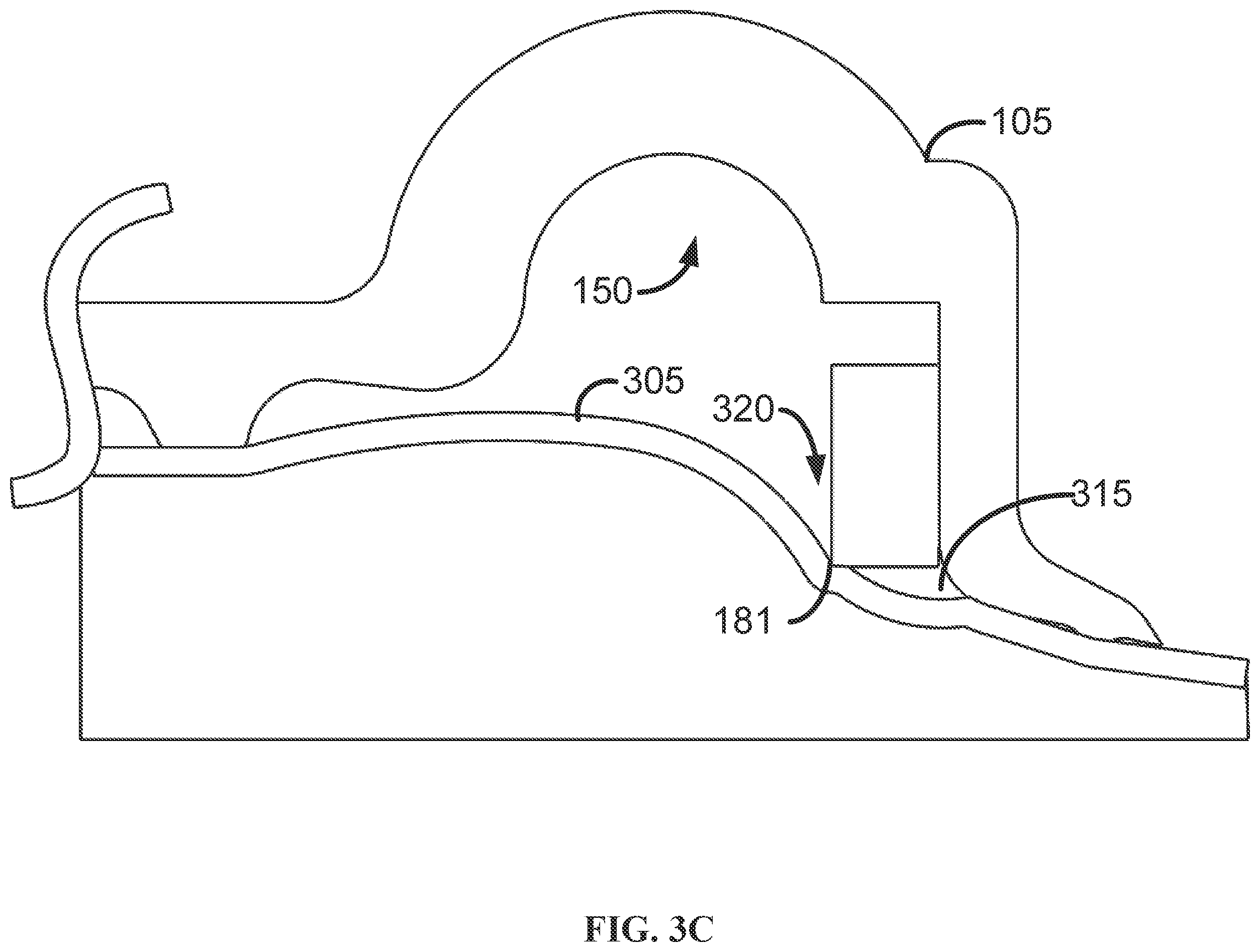 Patent US12167979 Figure 10 – Phacomachine irrigation and aspiration integration for capsulotomy device