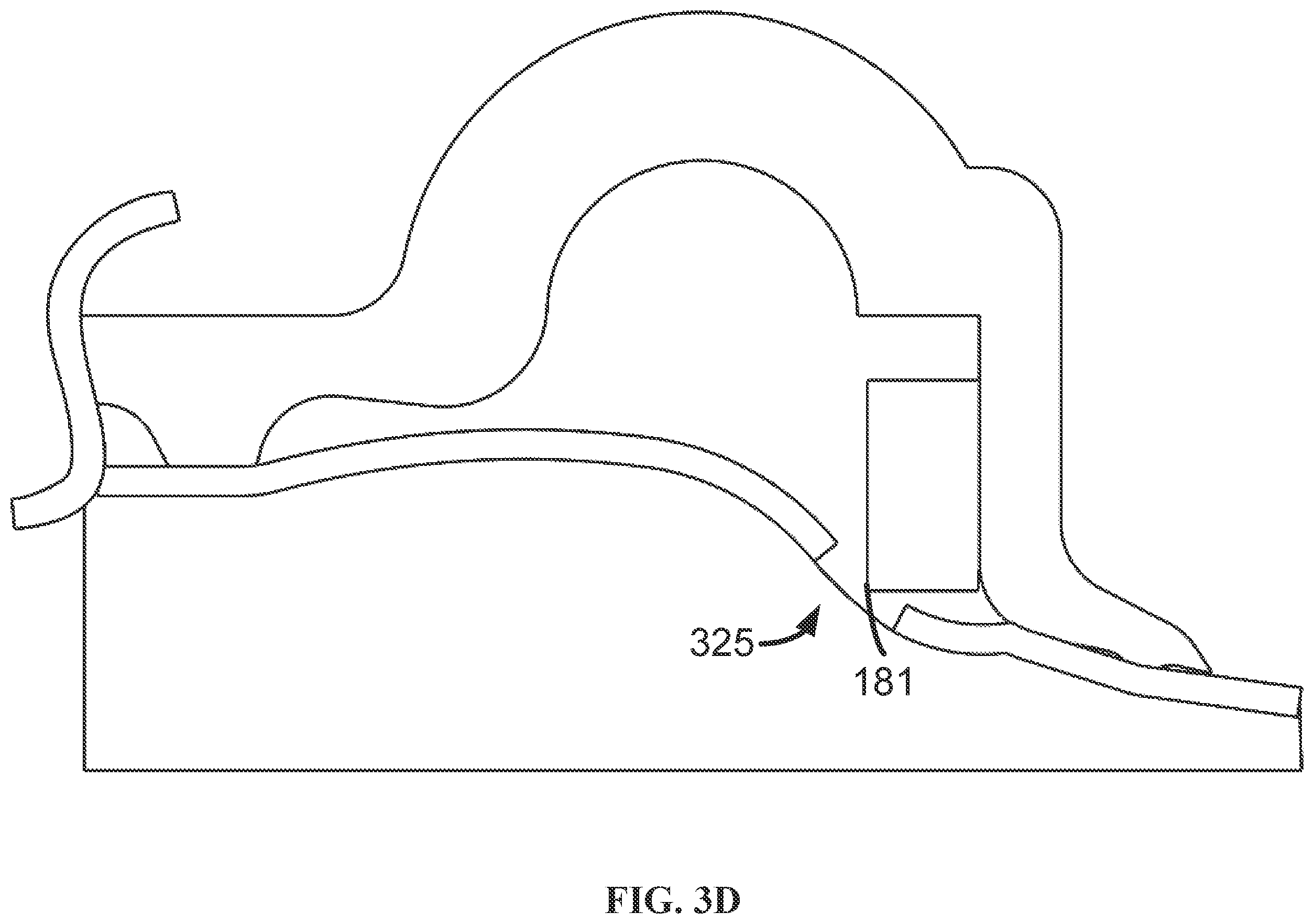 Patent US12167979 Figure 11 – Phacomachine irrigation and aspiration integration for capsulotomy device