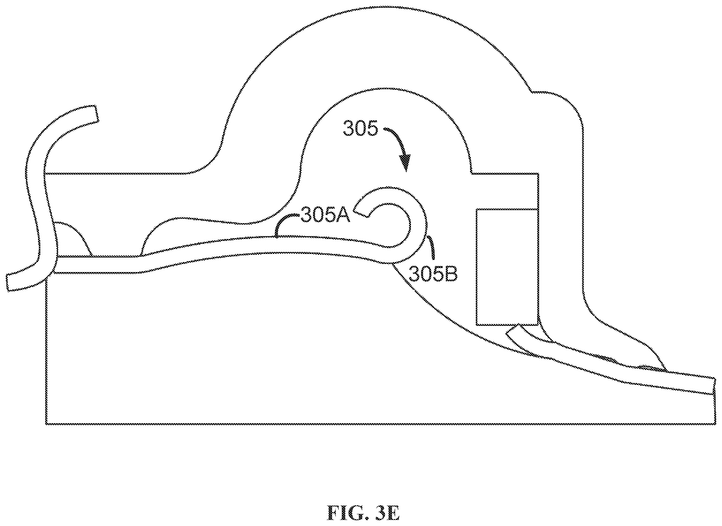 Patent US12167979 Figure 12 – Phacomachine irrigation and aspiration integration for capsulotomy device