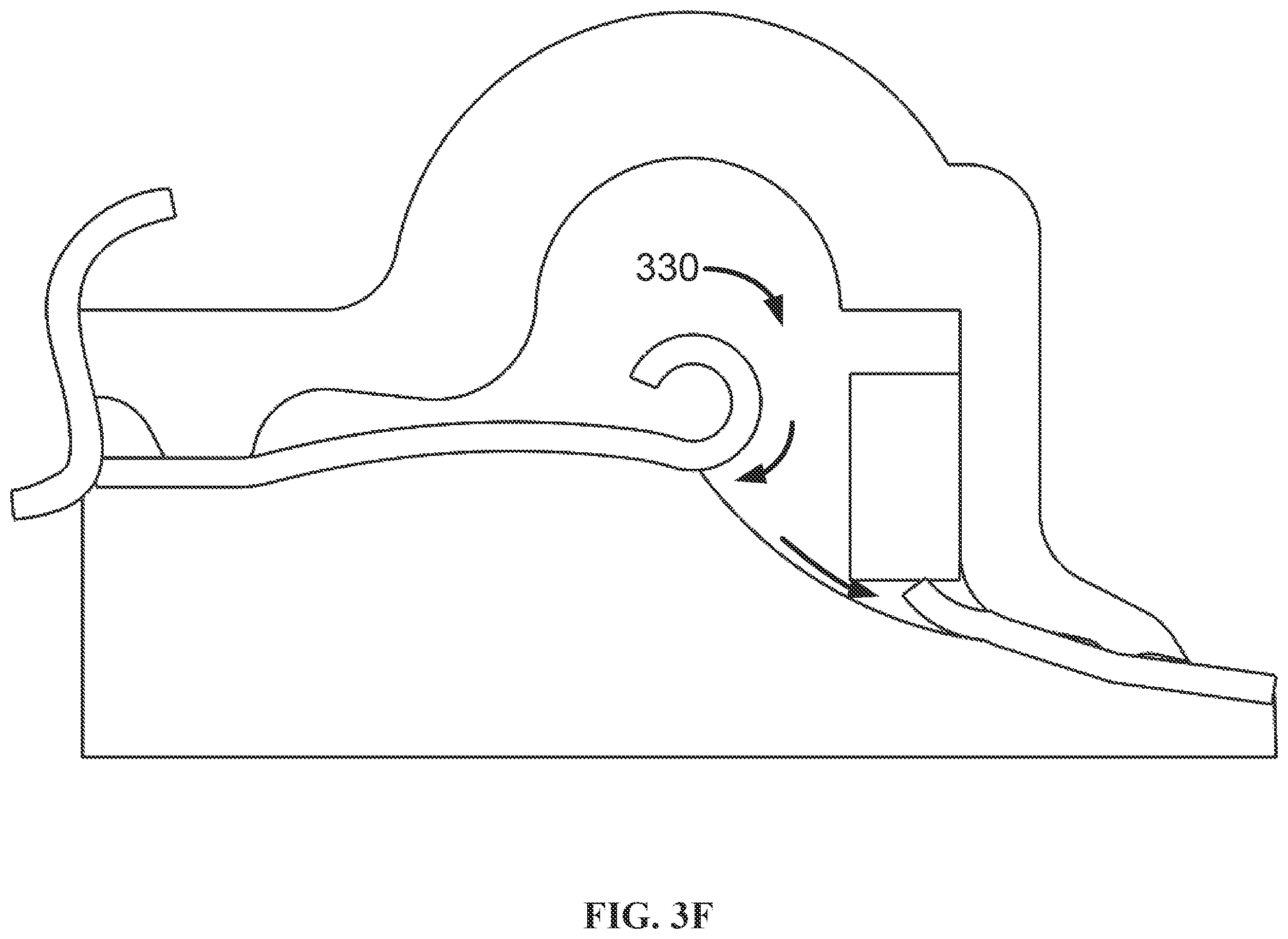 Patent US12167979 Figure 13 – Phacomachine irrigation and aspiration integration for capsulotomy device