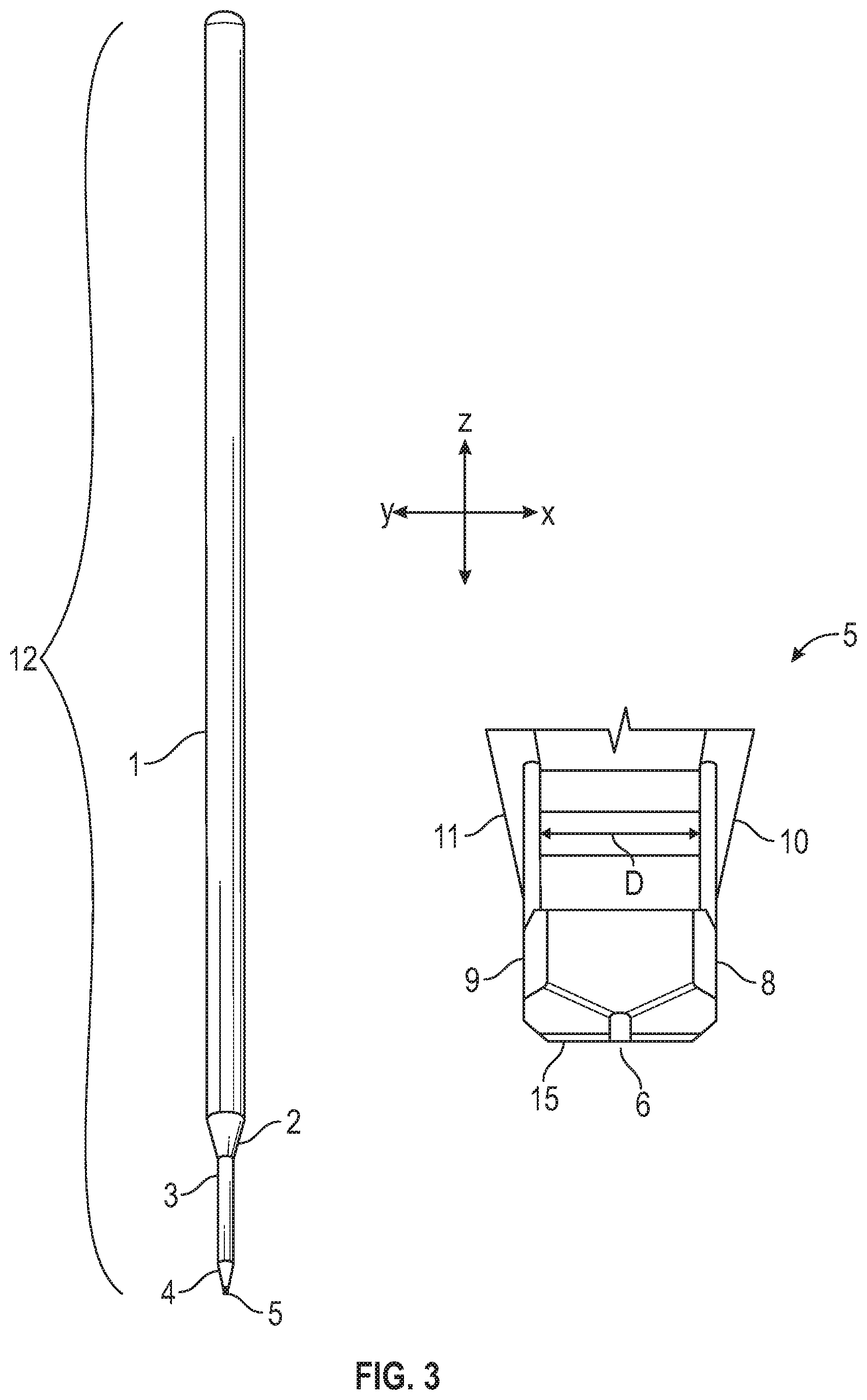 Patent US12167980 Figure 3 – Intraocular device for dual incisions