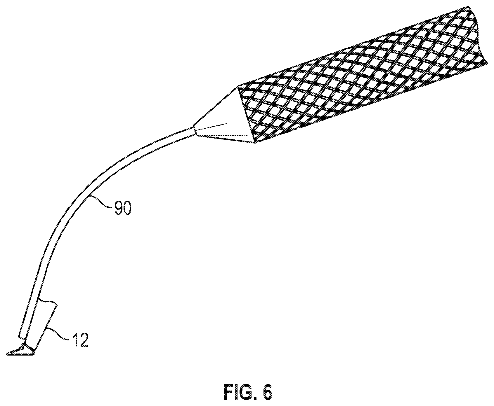 Patent US12167980 Figure 6 – Intraocular device for dual incisions