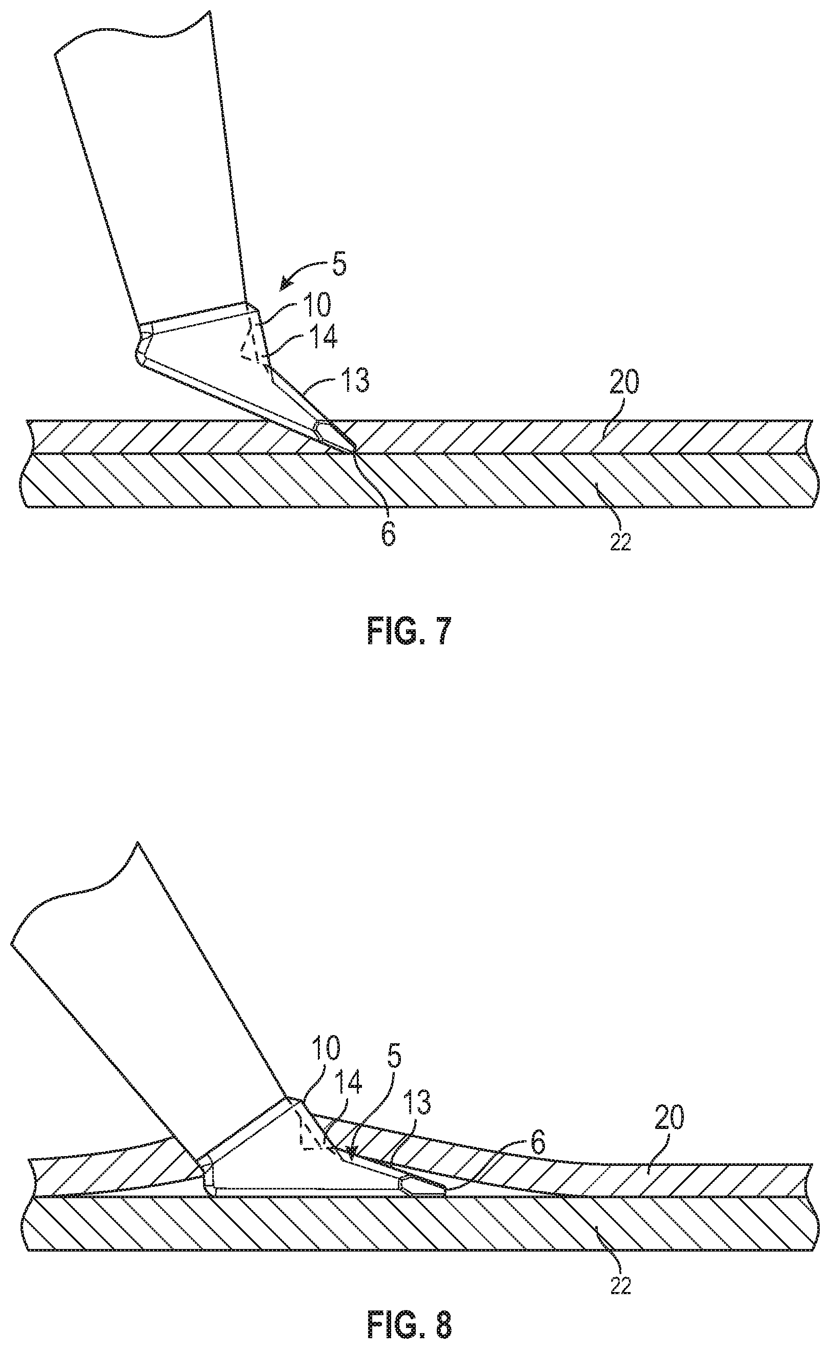 Patent US12167980 Figure 7 – Intraocular device for dual incisions
