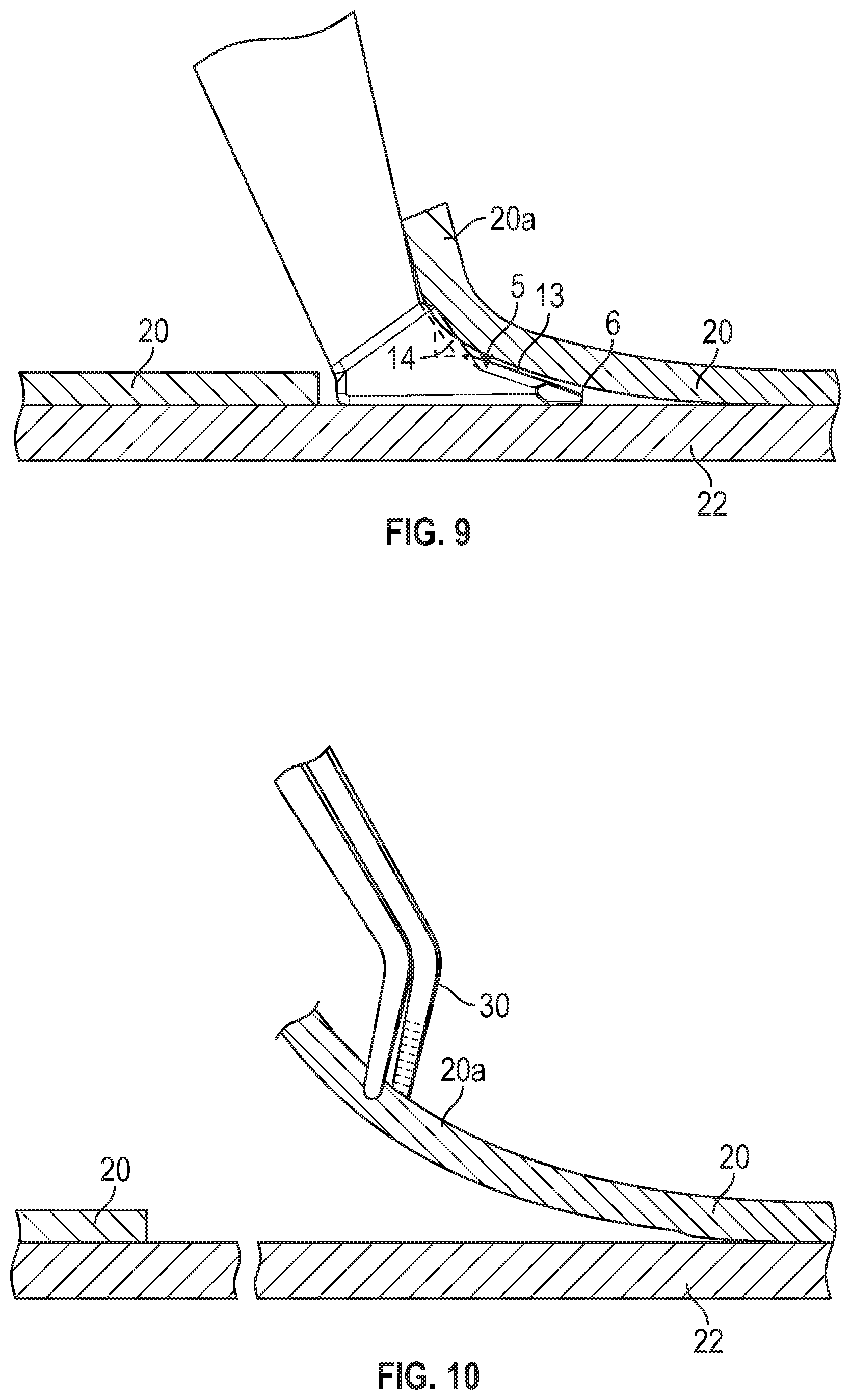 Patent US12167980 Figure 8 – Intraocular device for dual incisions