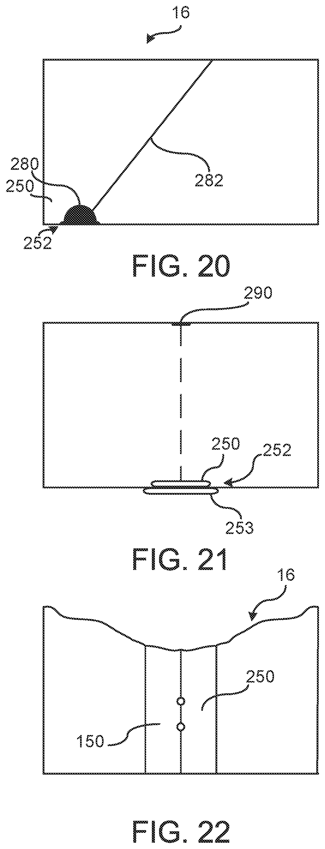 Patent US12167987 Figure 10 – Dynamic support apparatus