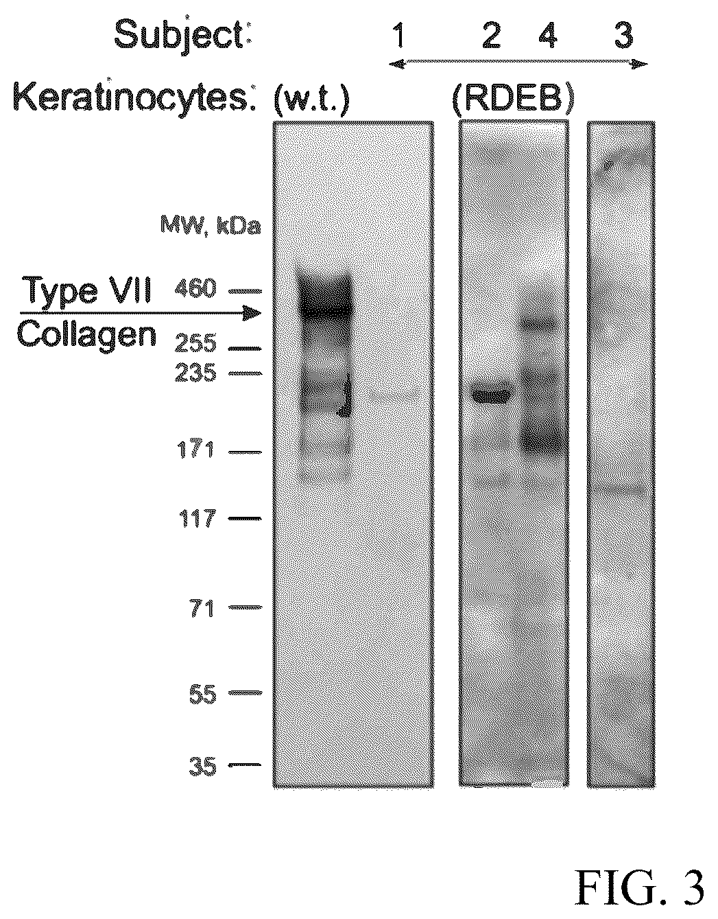 Patent US12173314 Figure 3 – Gene therapy for recessive dystrophic epidermolysis bullosa using genetically corrected autologous keratinocytes