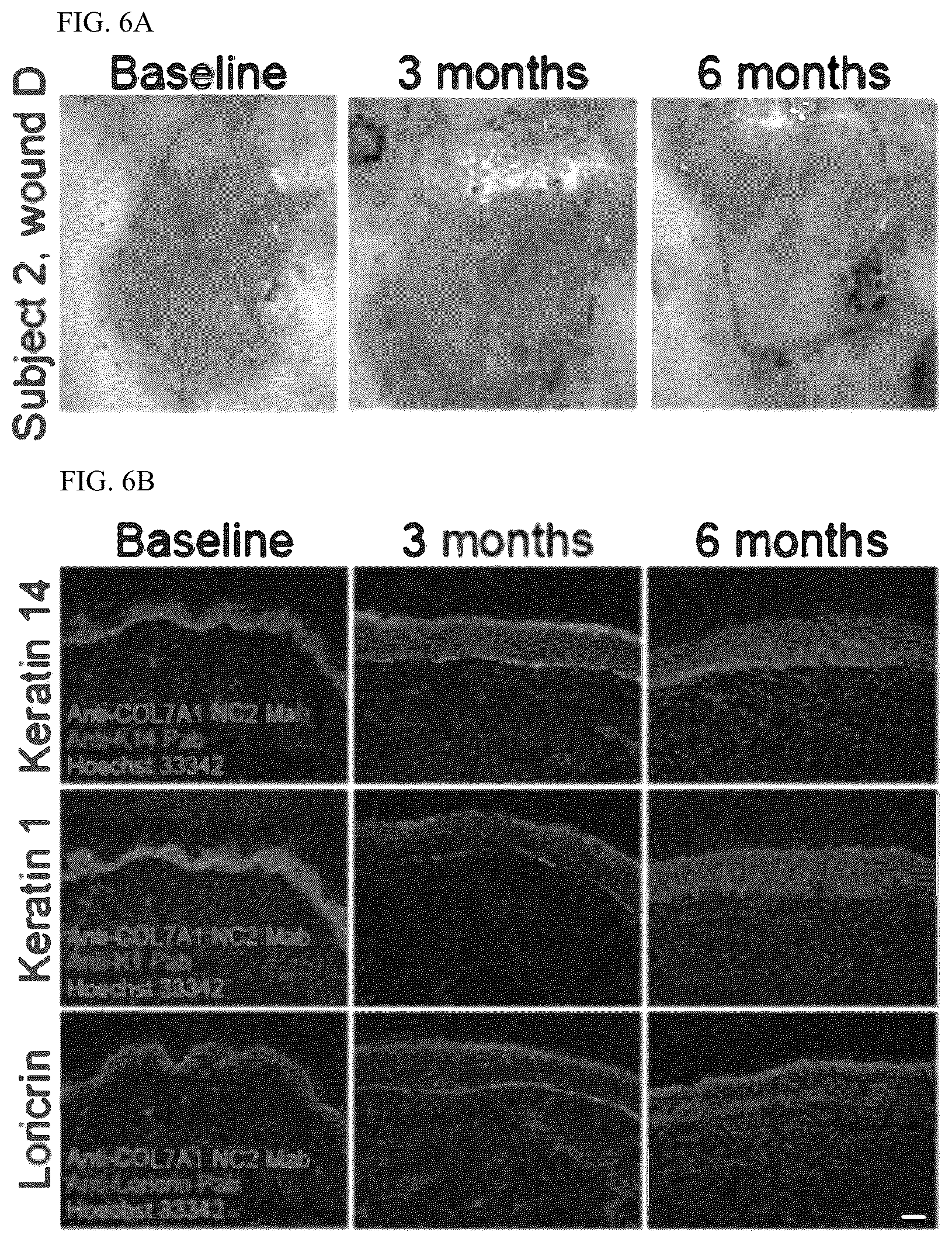 Patent US12173314 Figure 6 – Gene therapy for recessive dystrophic epidermolysis bullosa using genetically corrected autologous keratinocytes
