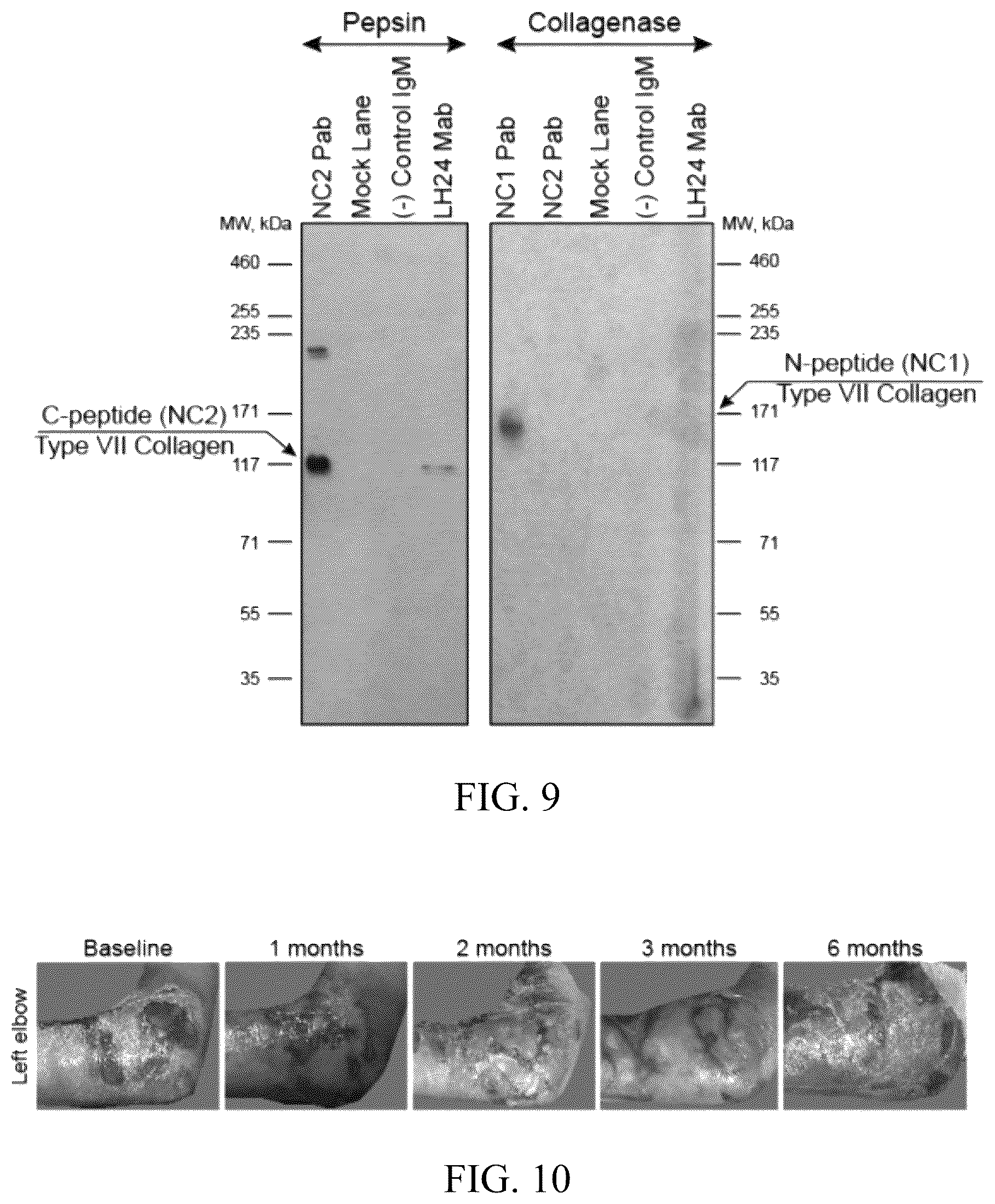 Patent US12173314 Figure 9 – Gene therapy for recessive dystrophic epidermolysis bullosa using genetically corrected autologous keratinocytes