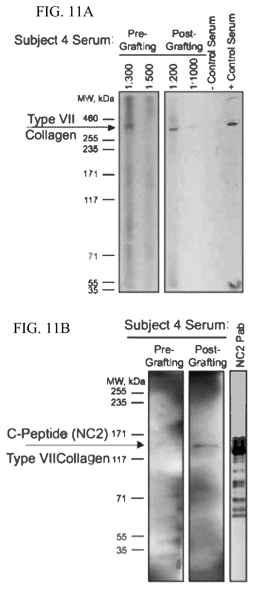 Patent US12173314 Figure 10 – Gene therapy for recessive dystrophic epidermolysis bullosa using genetically corrected autologous keratinocytes