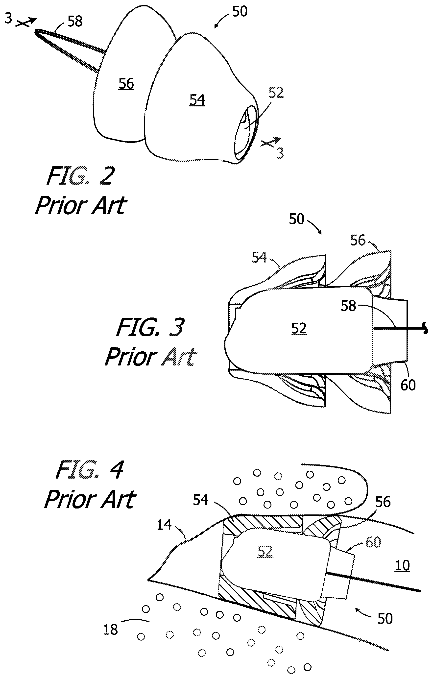Patent US12174014 Figure 2 – Canal hearing device sizer tools, systems and methods