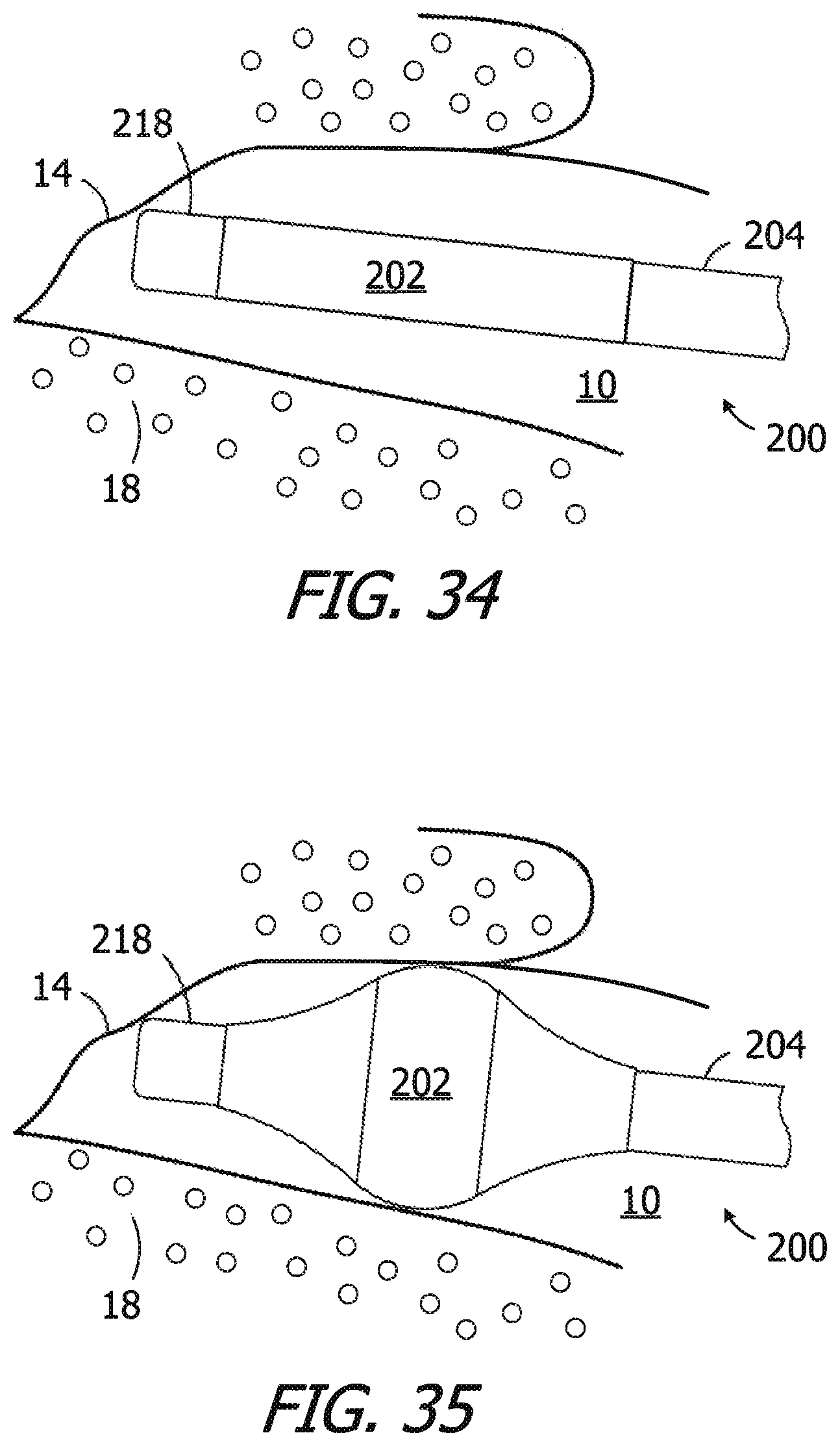 Patent US12174014 Figure 9 – Canal hearing device sizer tools, systems and methods