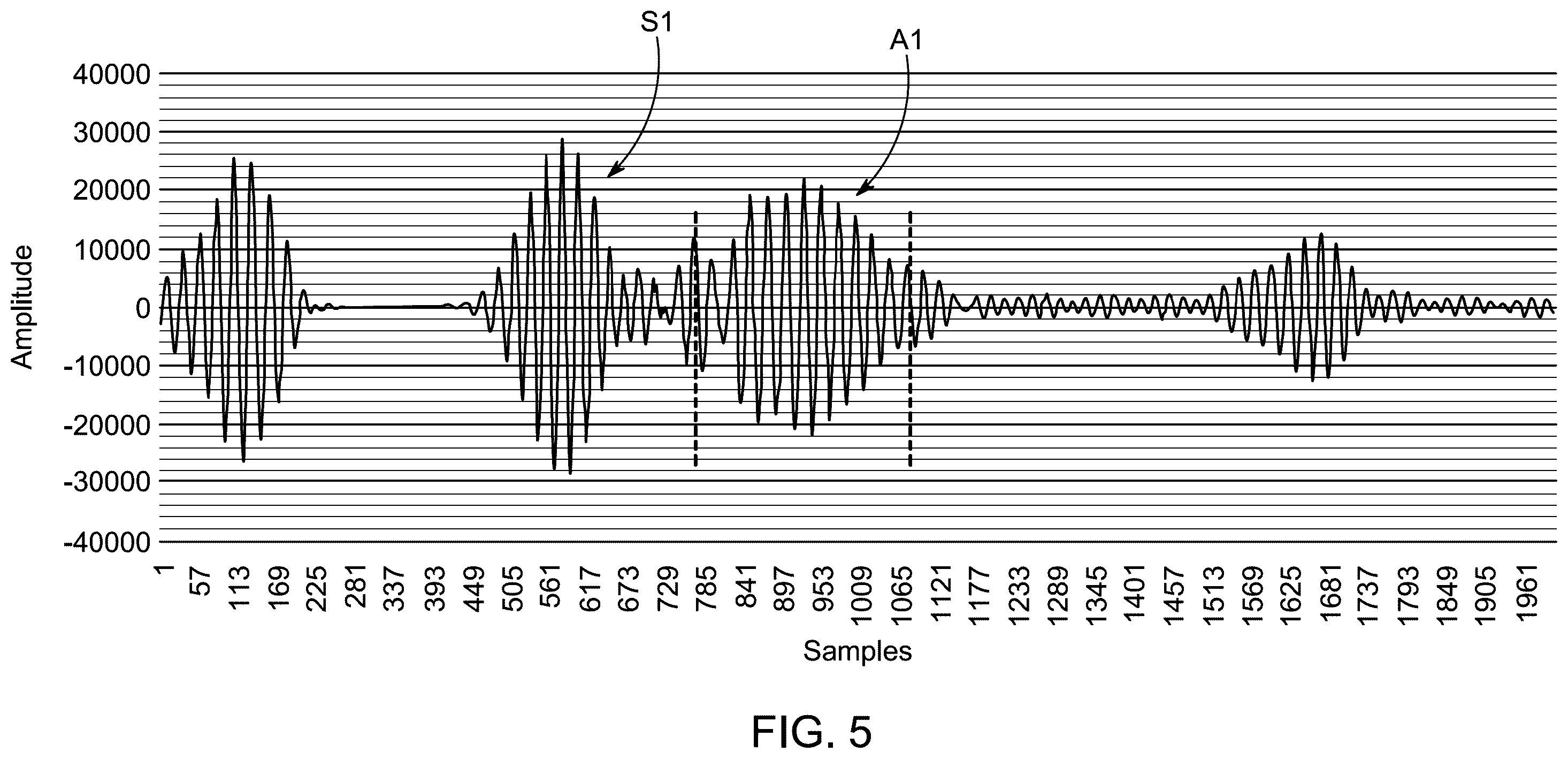 Patent US12174150 Figure 5 – Method for detecting defects in a pipeline