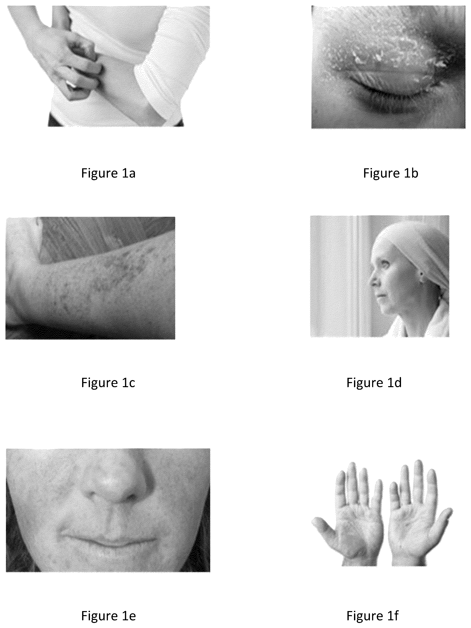 Patent US12174172 Figure 1 – Method for evaluating the efficacy of a composition in reducing the effects of cancer therapeutics on skin