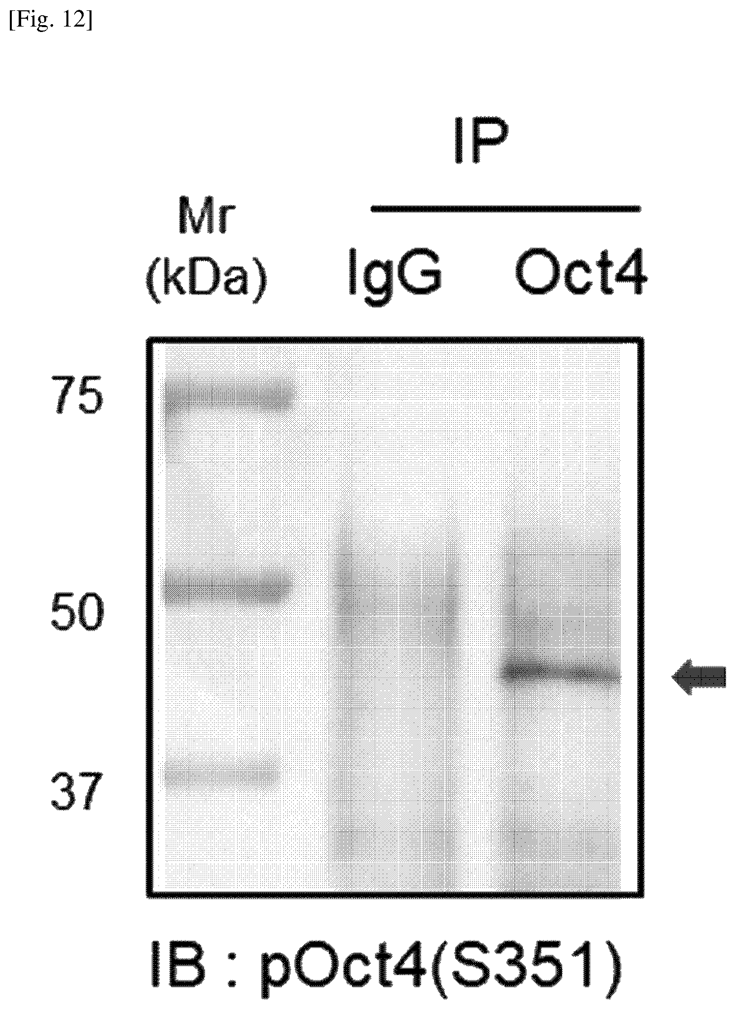 Patent US12174174 Figure 12 – Composition comprising material for regulating OCT4 modification to repress stemness
