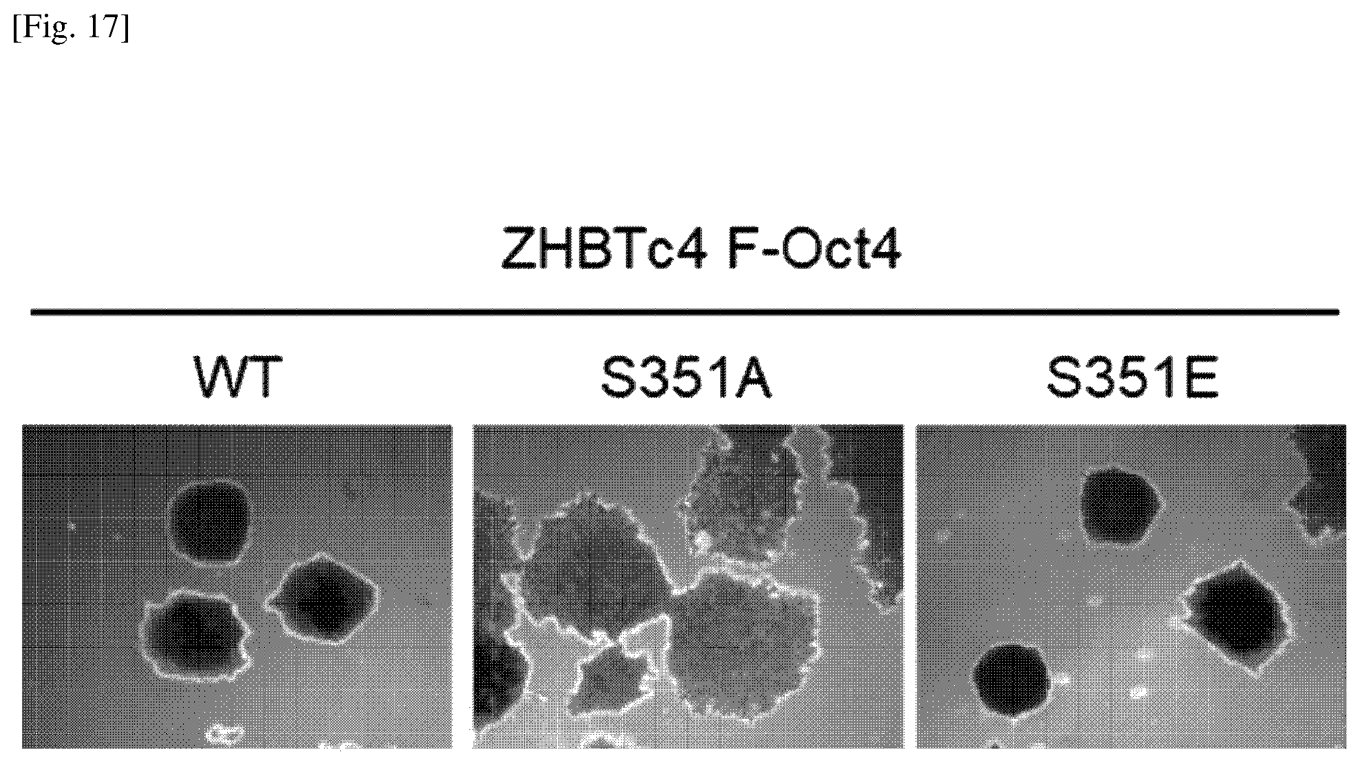 Patent US12174174 Figure 17 – Composition comprising material for regulating OCT4 modification to repress stemness
