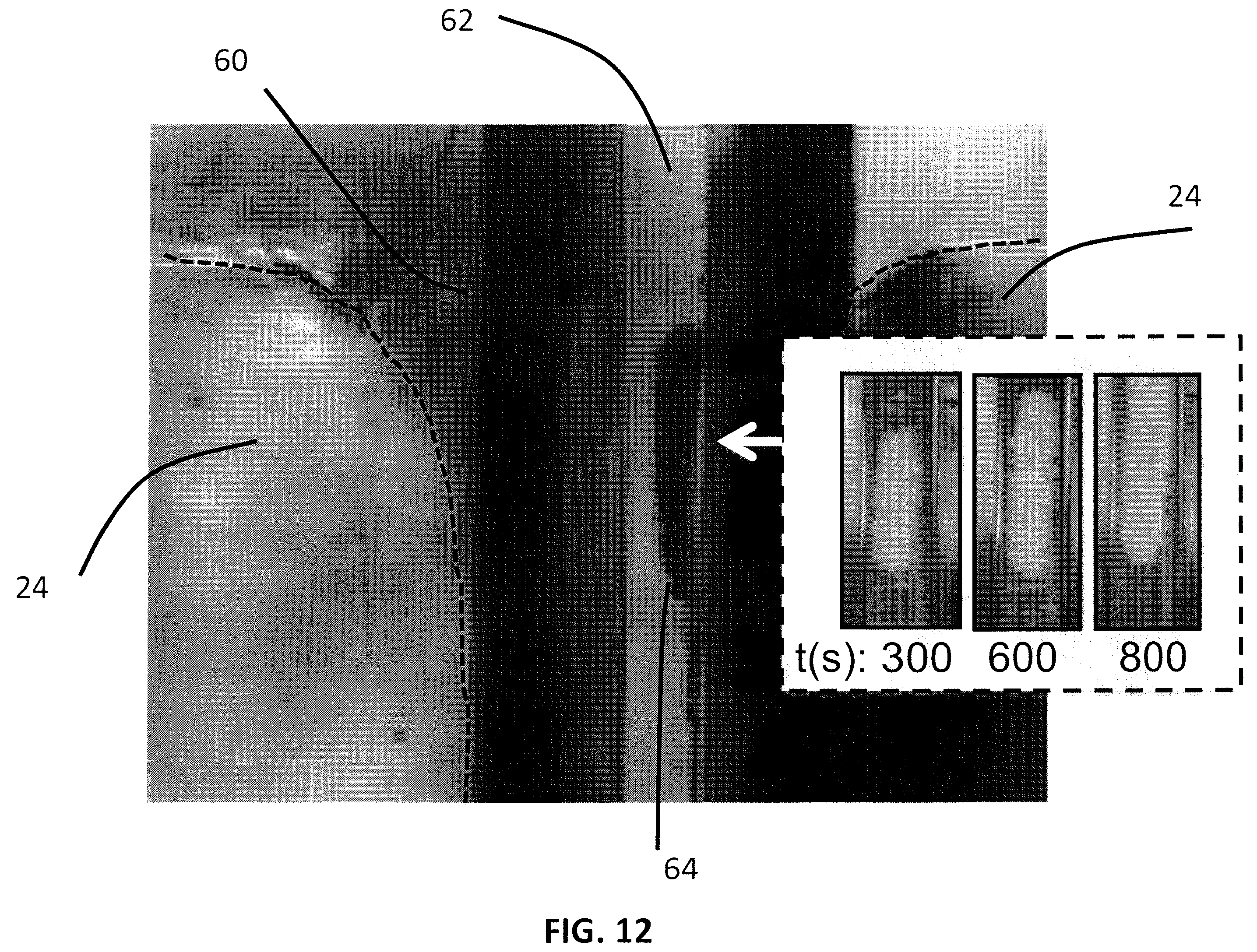 Patent US12174179 Figure 12 – Devices and methods for detection and quantification of immunological proteins, pathogenic and microbial agents and cells