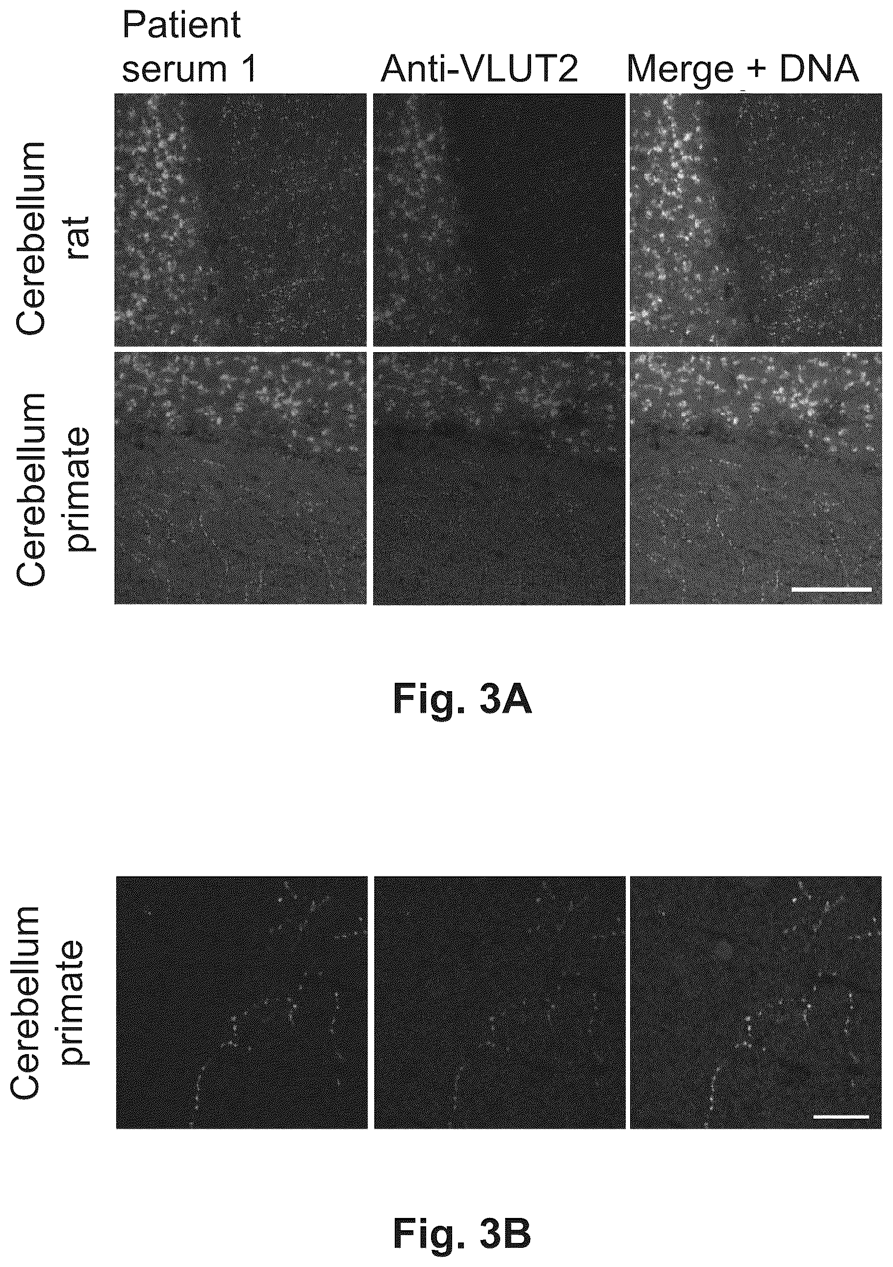 Patent US12174186 Figure 3 – Method and reagents for the detection of an autoantibody