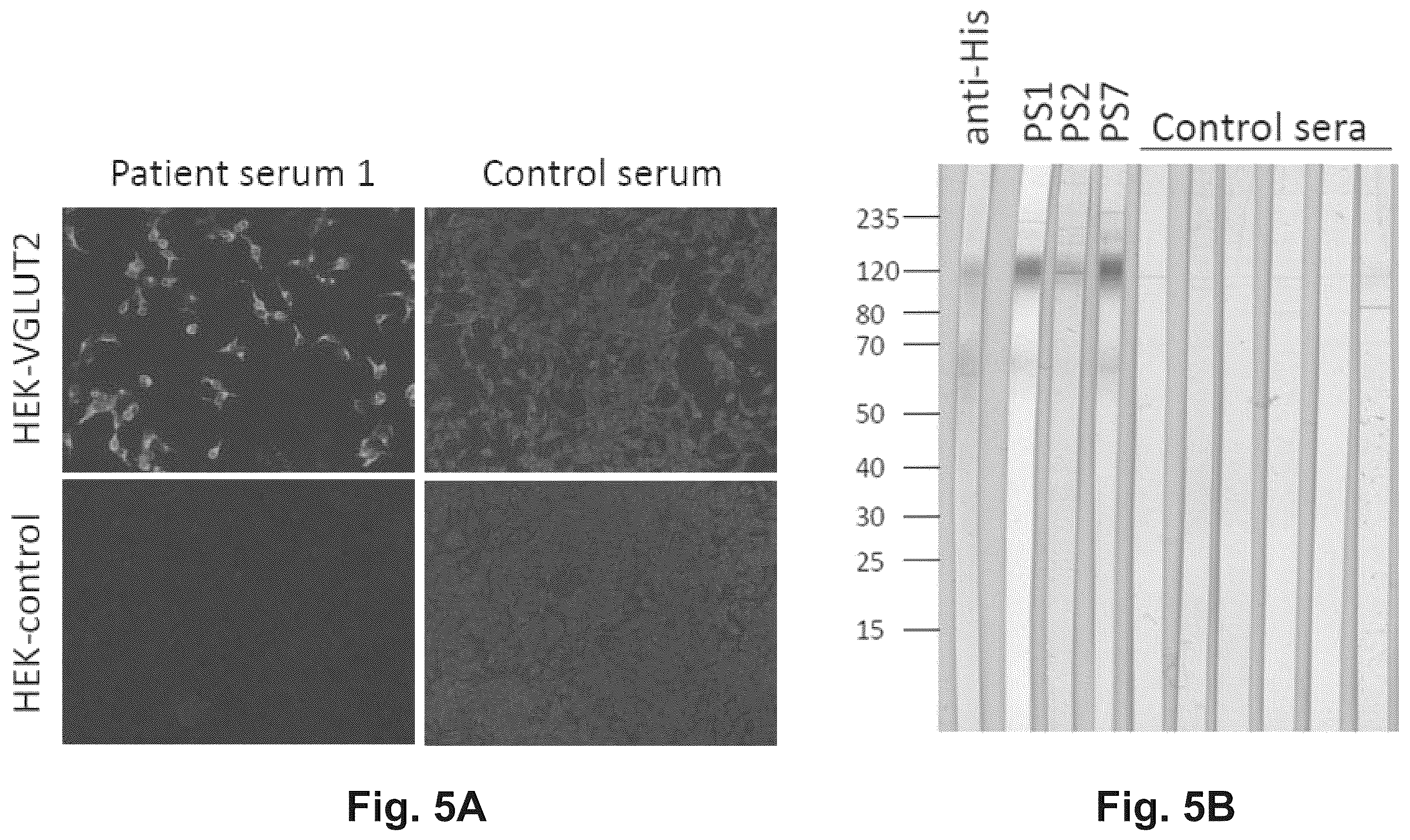 Patent US12174186 Figure 5 – Method and reagents for the detection of an autoantibody