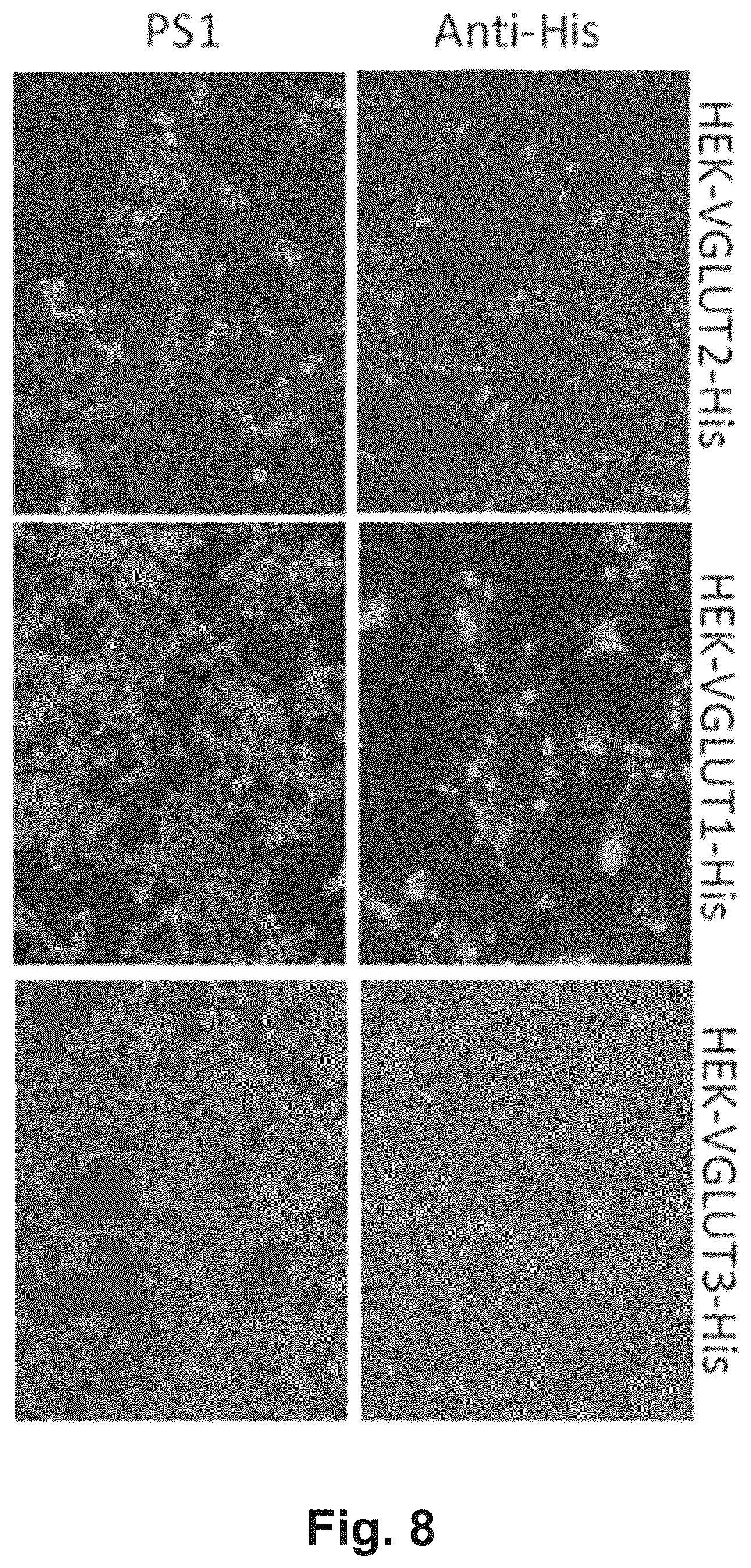 Patent US12174186 Figure 11 – Method and reagents for the detection of an autoantibody
