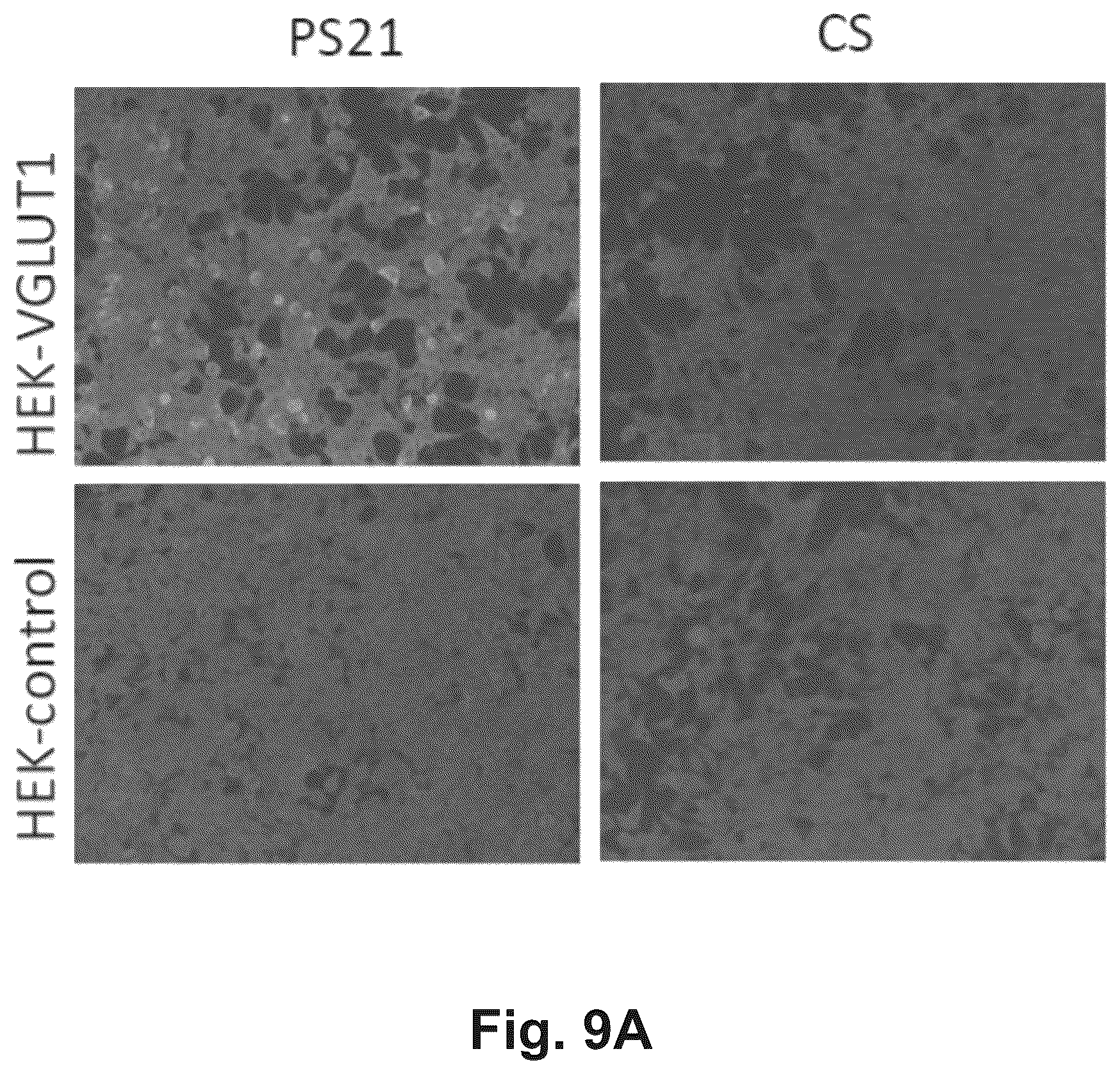 Patent US12174186 Figure 12 – Method and reagents for the detection of an autoantibody