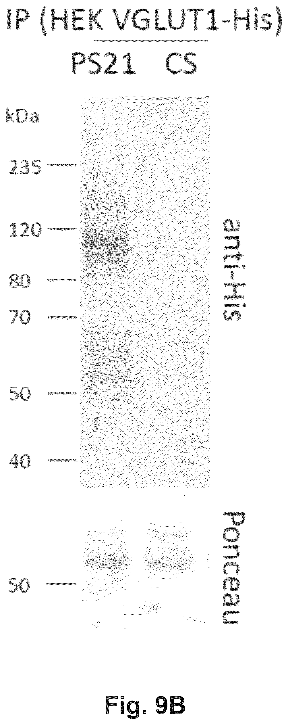 Patent US12174186 Figure 13 – Method and reagents for the detection of an autoantibody
