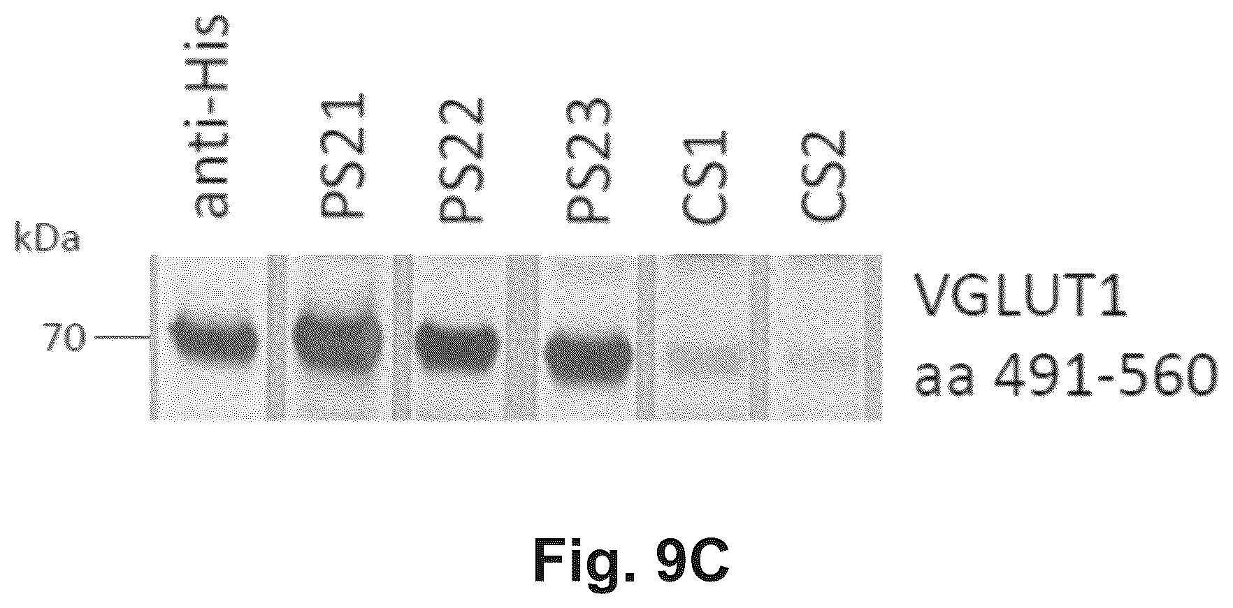 Patent US12174186 Figure 14 – Method and reagents for the detection of an autoantibody