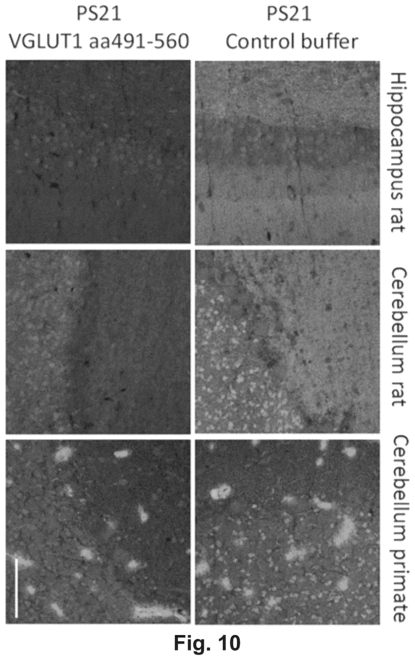 Patent US12174186 Figure 15 – Method and reagents for the detection of an autoantibody