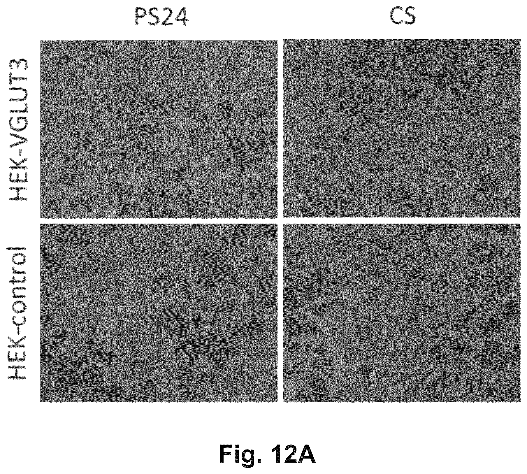 Patent US12174186 Figure 18 – Method and reagents for the detection of an autoantibody