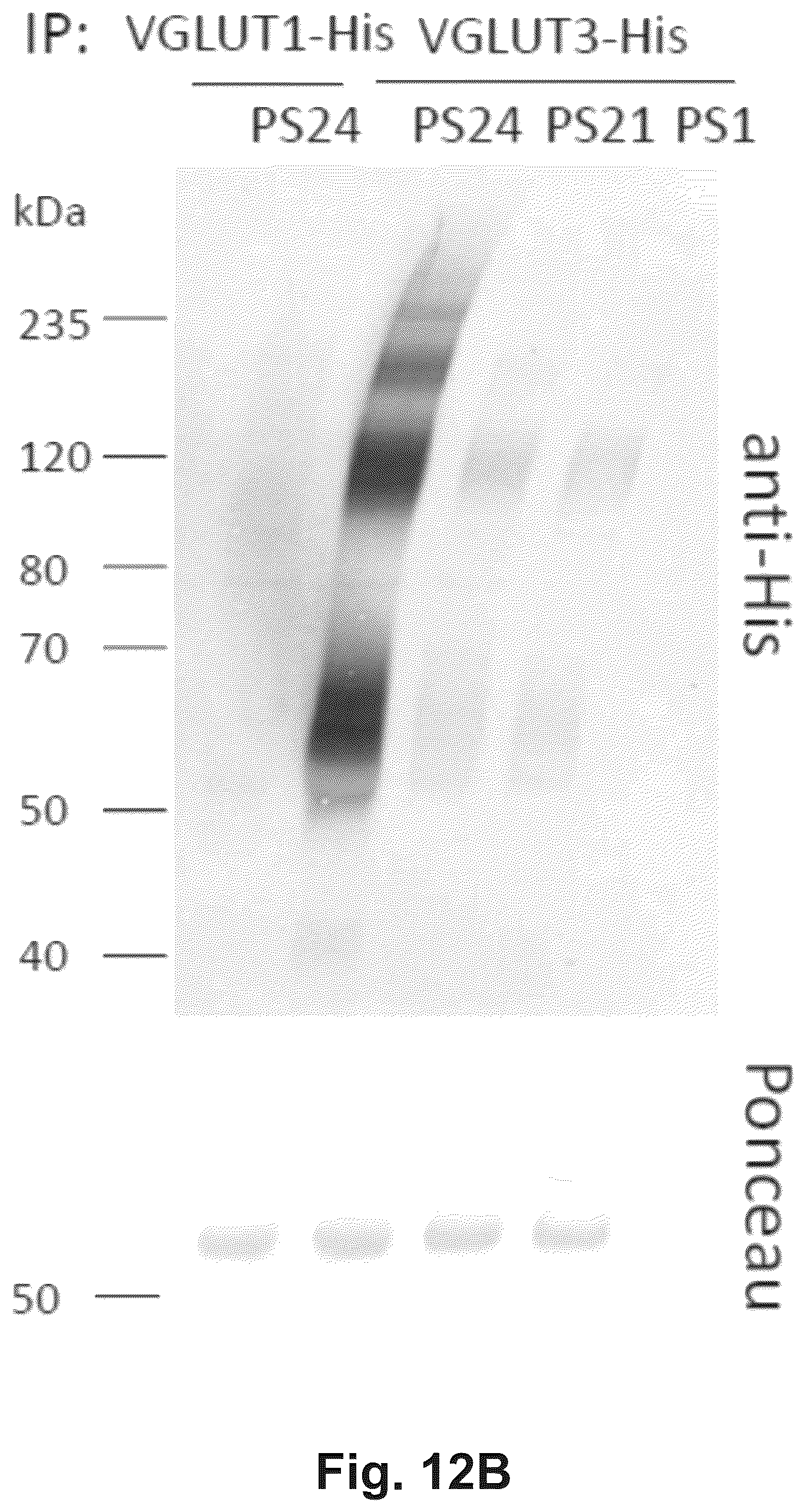 Patent US12174186 Figure 19 – Method and reagents for the detection of an autoantibody