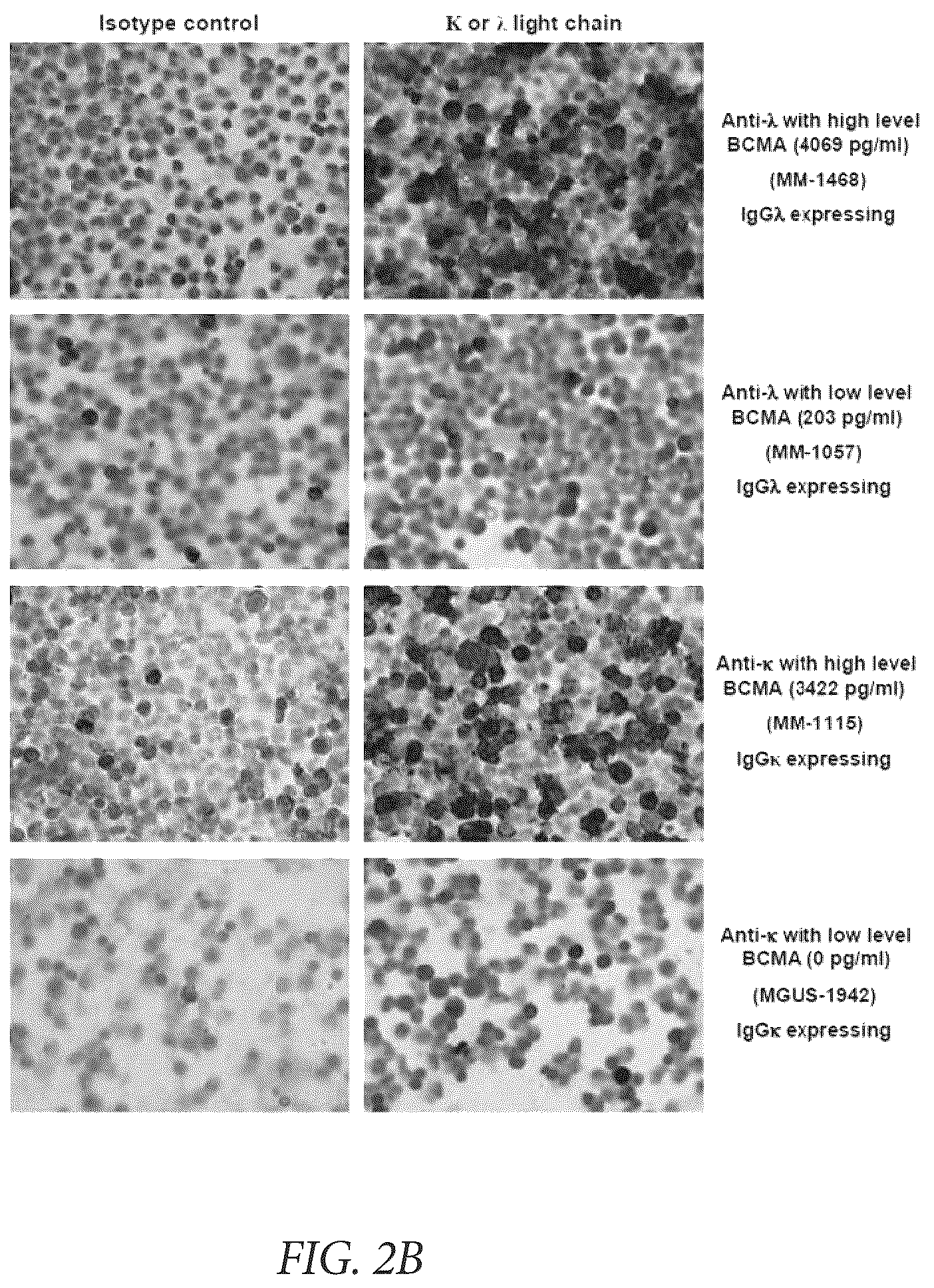 Patent US12174189 Figure 3 – Diagnostic, prognostic, and monitoring methods for chronic lymphocytic leukemia