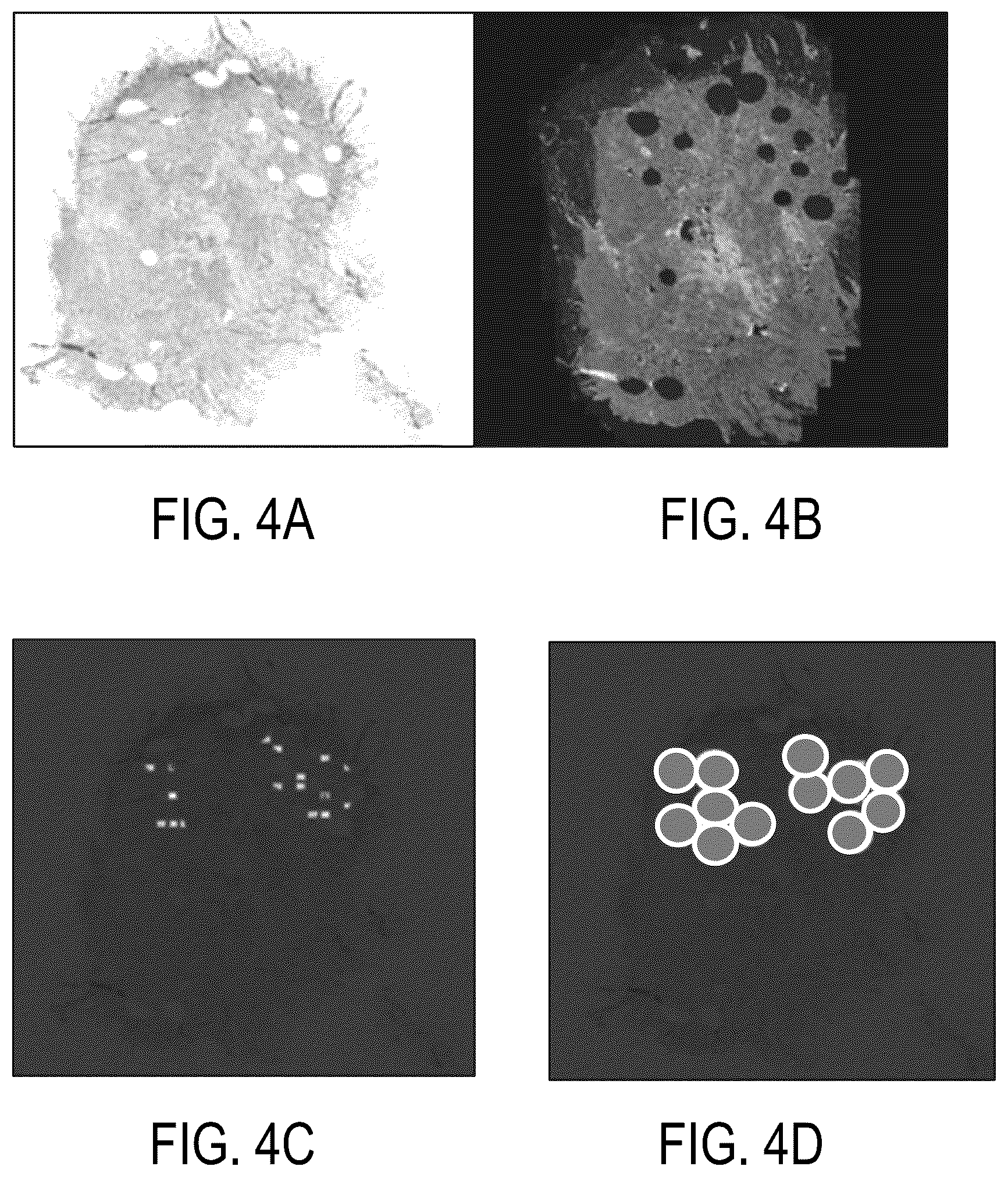 Patent US12174190 Figure 4 – Combined markers for metastatic cancer and uses thereof