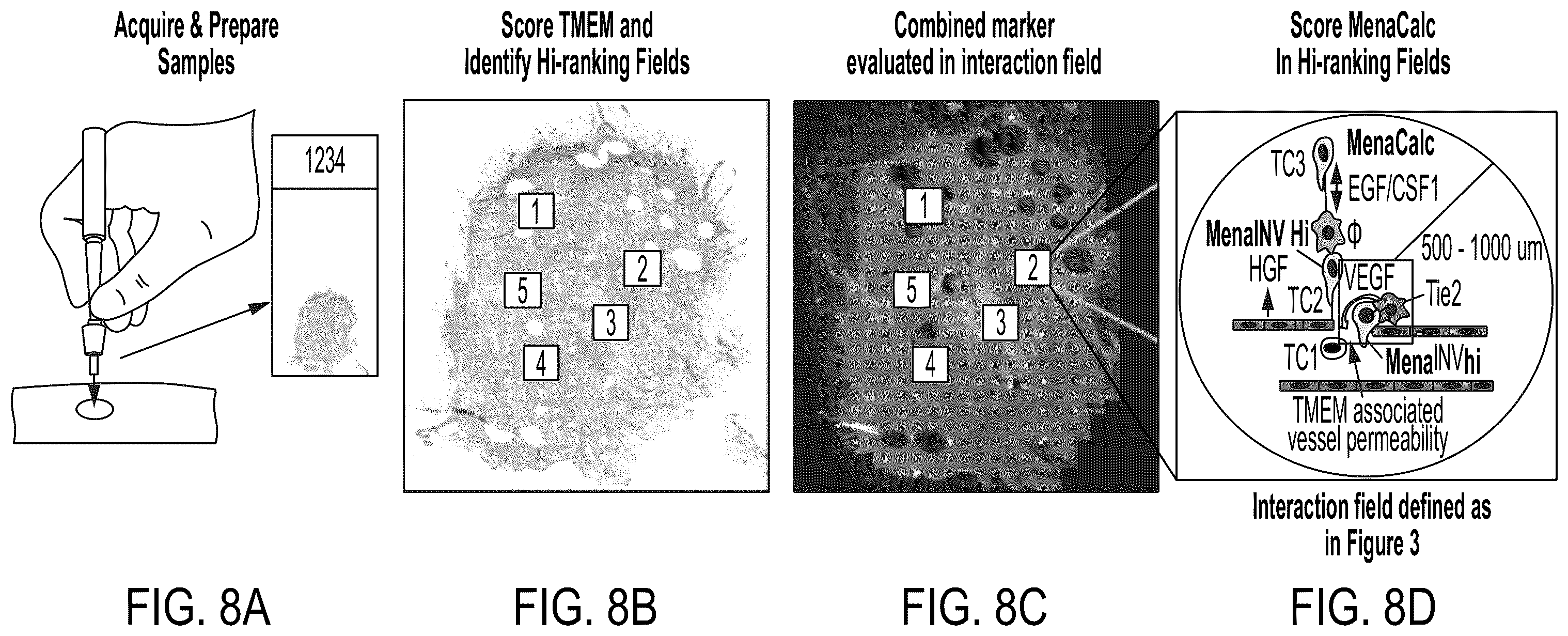 Patent US12174190 Figure 8 – Combined markers for metastatic cancer and uses thereof