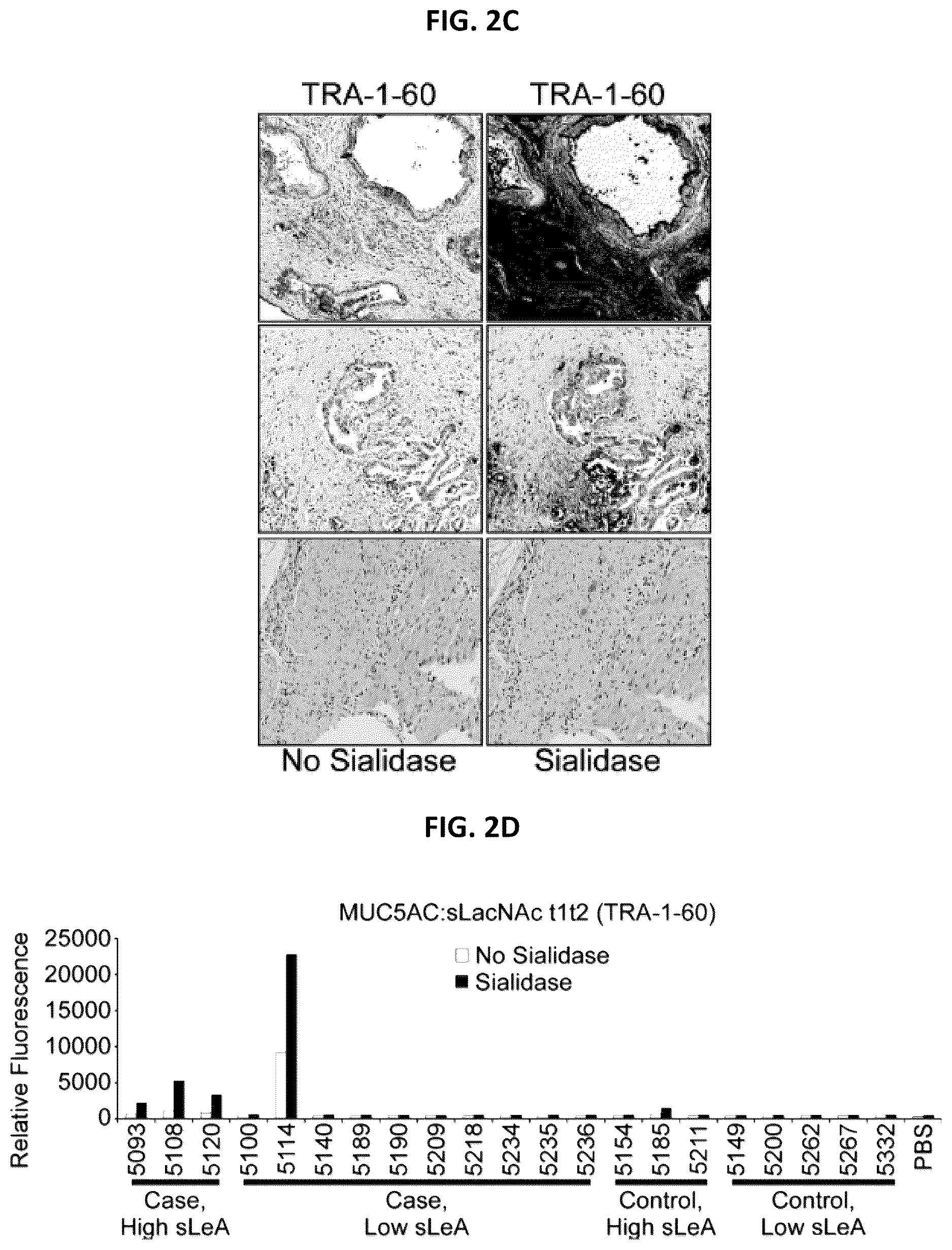 Patent US12174191 Figure 4 – Methods for detecting and for treating pancreatic cancer
