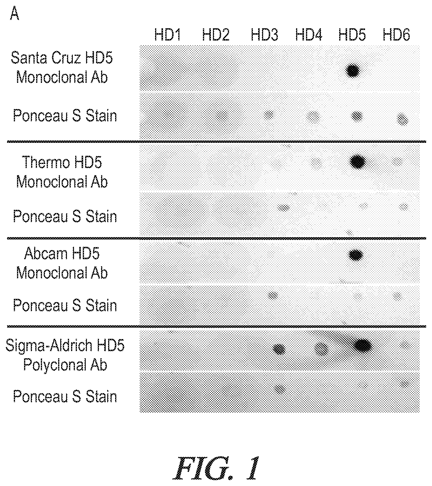 Patent US12174200 — Targeted HD5 antibody and assay methods for diagnosing and treating inflammatory bowel disease — Figure 1
