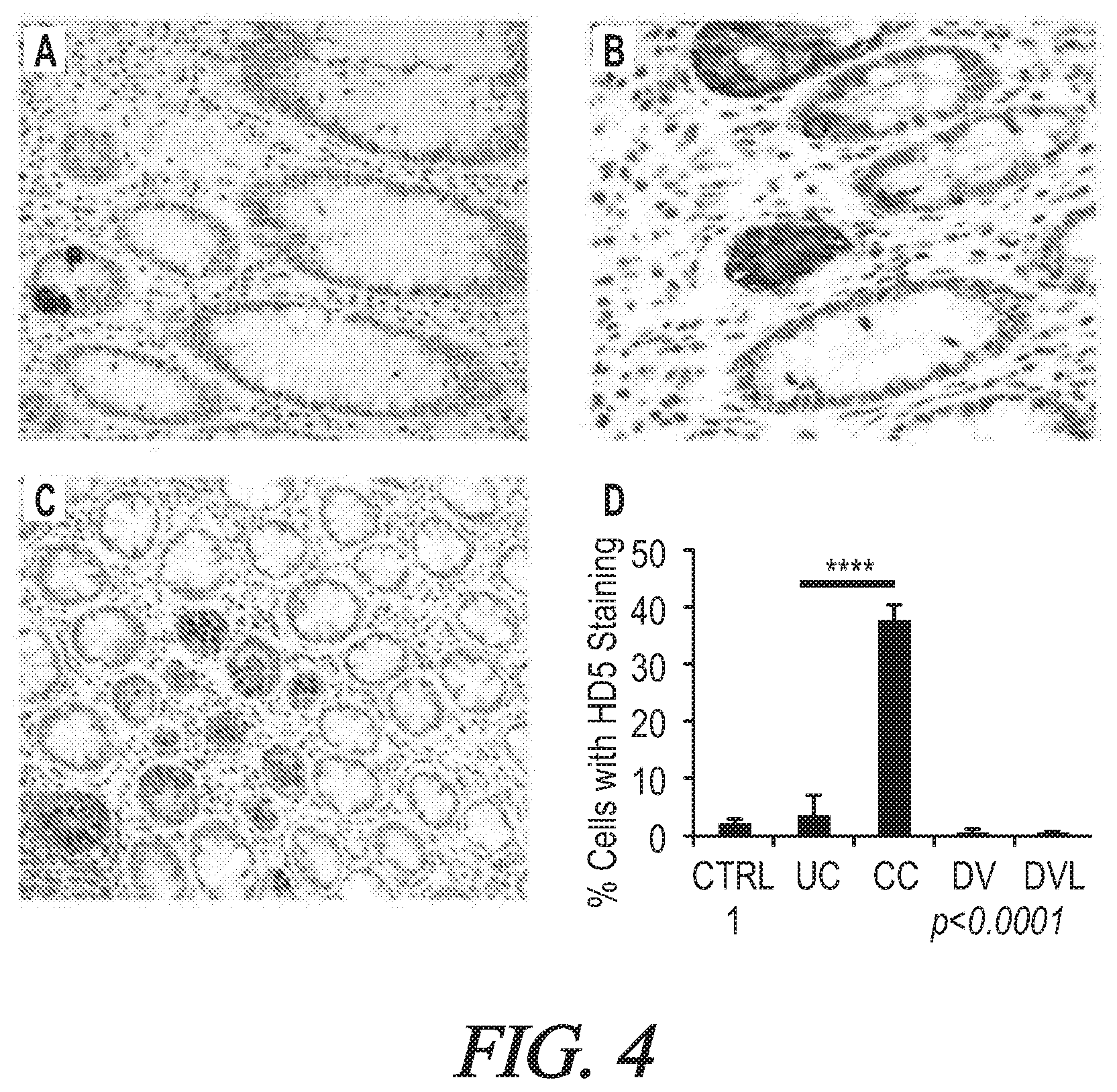 Patent US12174200 Figure 4 – Targeted HD5 antibody and assay methods for diagnosing and treating inflammatory bowel disease