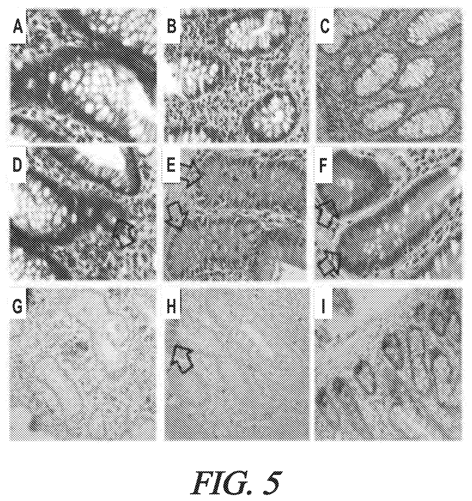 Patent US12174200 Figure 5 – Targeted HD5 antibody and assay methods for diagnosing and treating inflammatory bowel disease