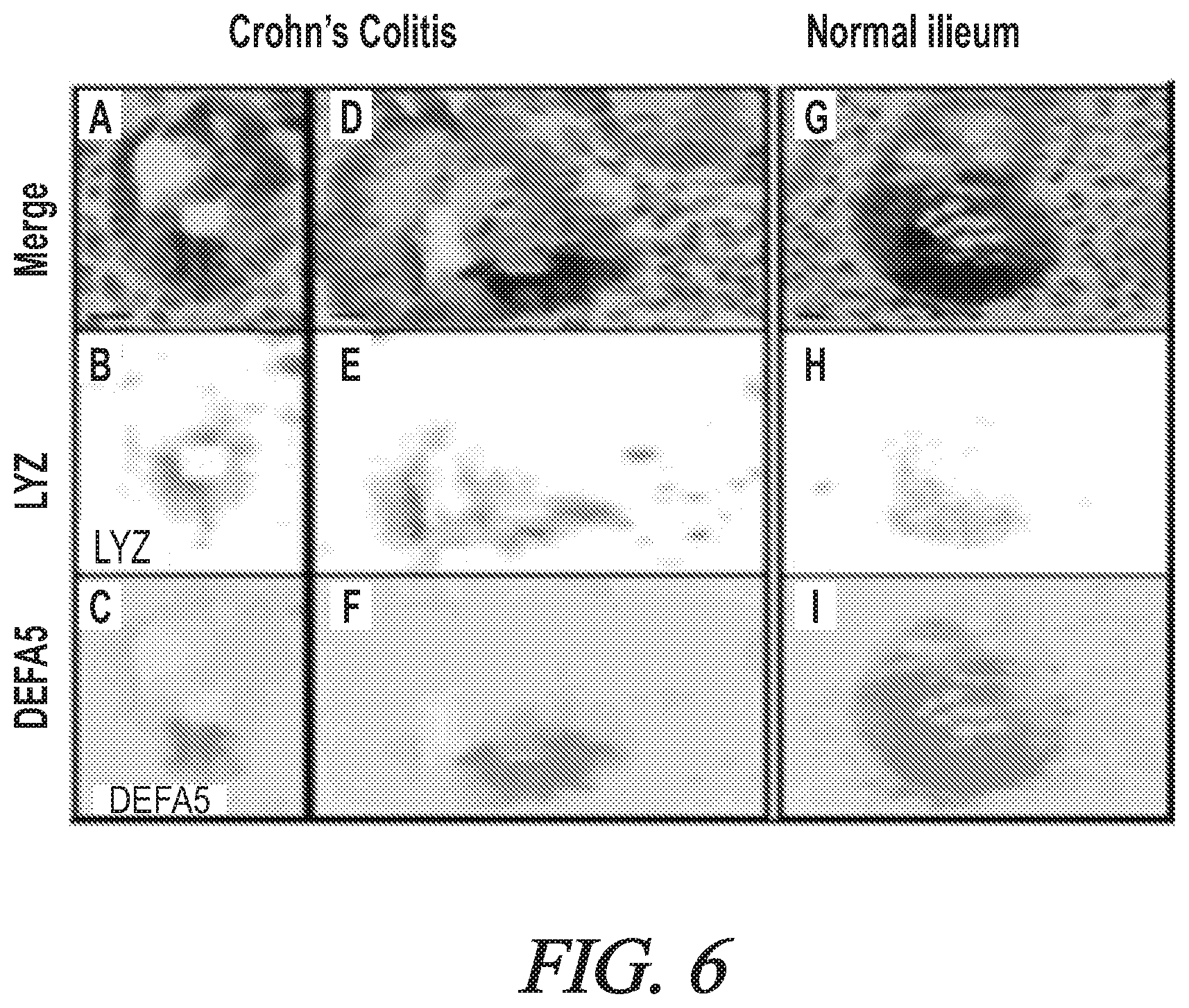 Patent US12174200 Figure 6 – Targeted HD5 antibody and assay methods for diagnosing and treating inflammatory bowel disease