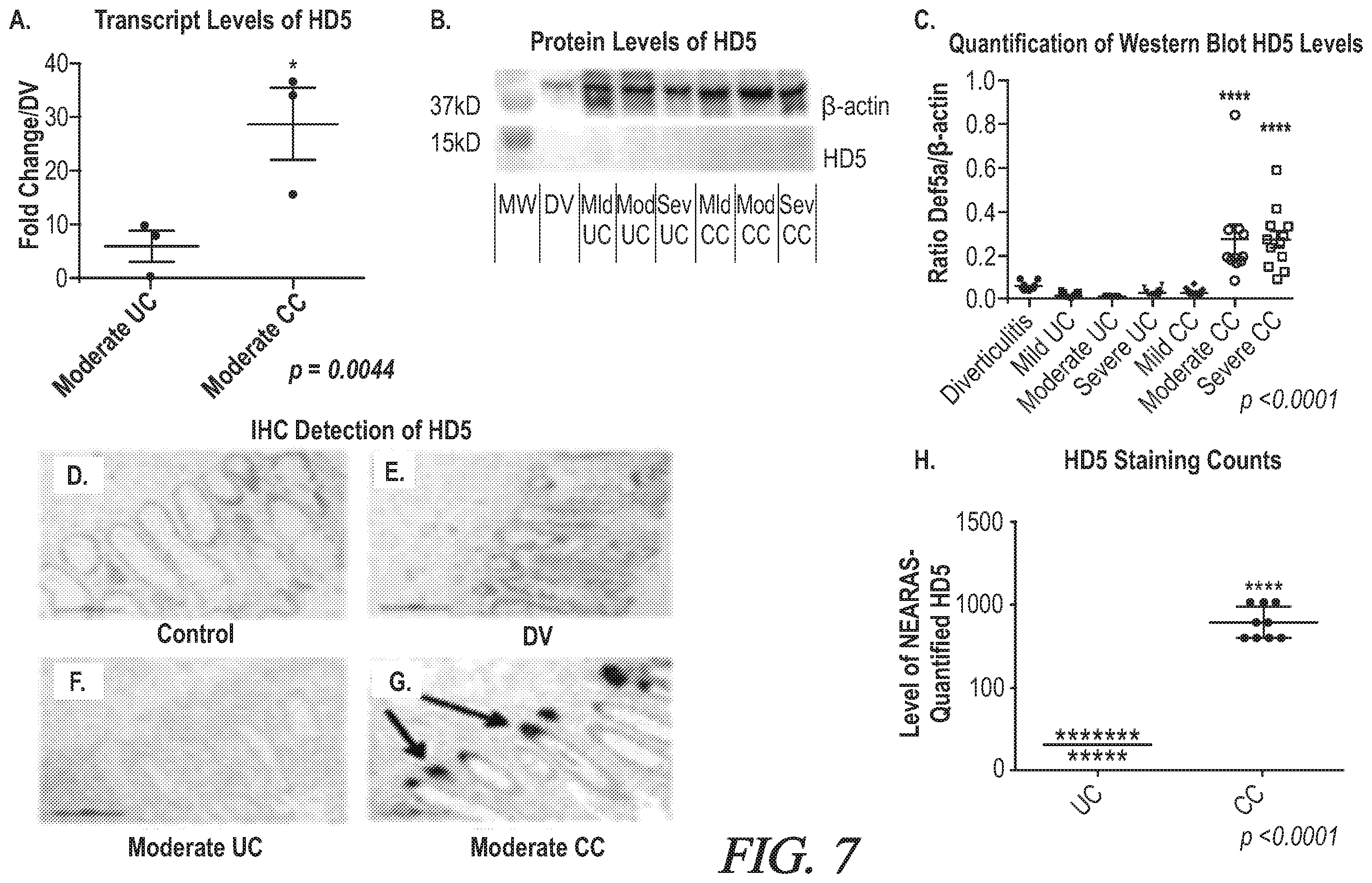 Patent US12174200 Figure 7 – Targeted HD5 antibody and assay methods for diagnosing and treating inflammatory bowel disease