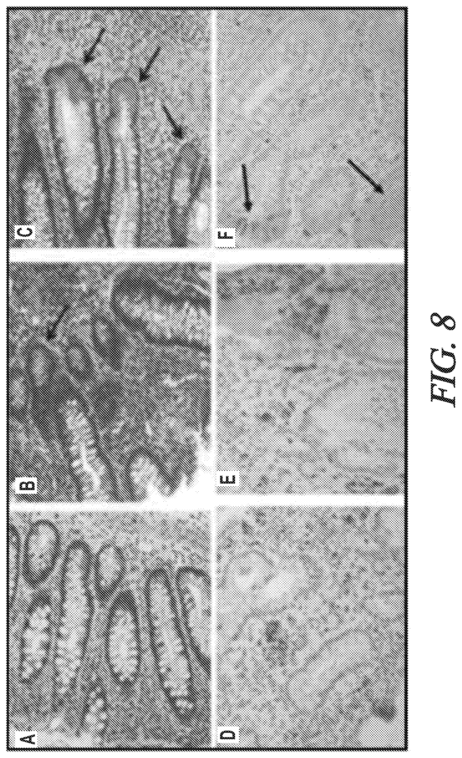 Patent US12174200 Figure 8 – Targeted HD5 antibody and assay methods for diagnosing and treating inflammatory bowel disease