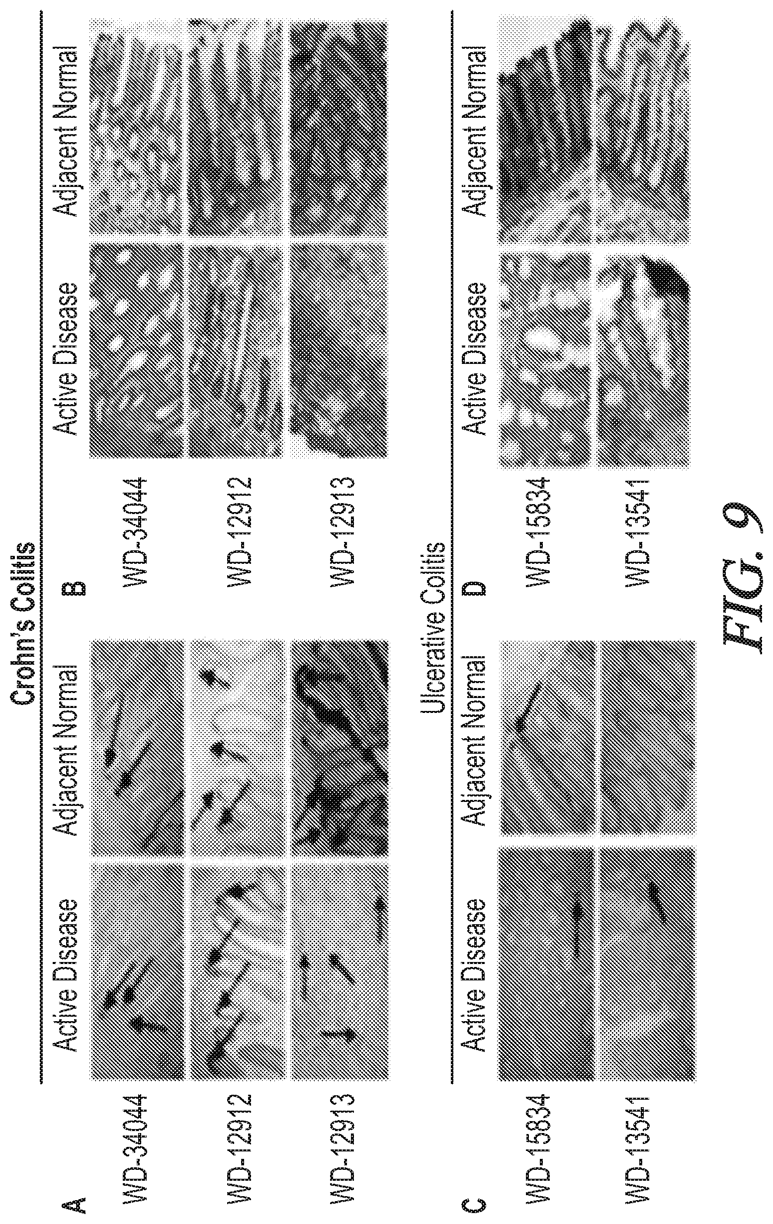 Patent US12174200 Figure 9 – Targeted HD5 antibody and assay methods for diagnosing and treating inflammatory bowel disease