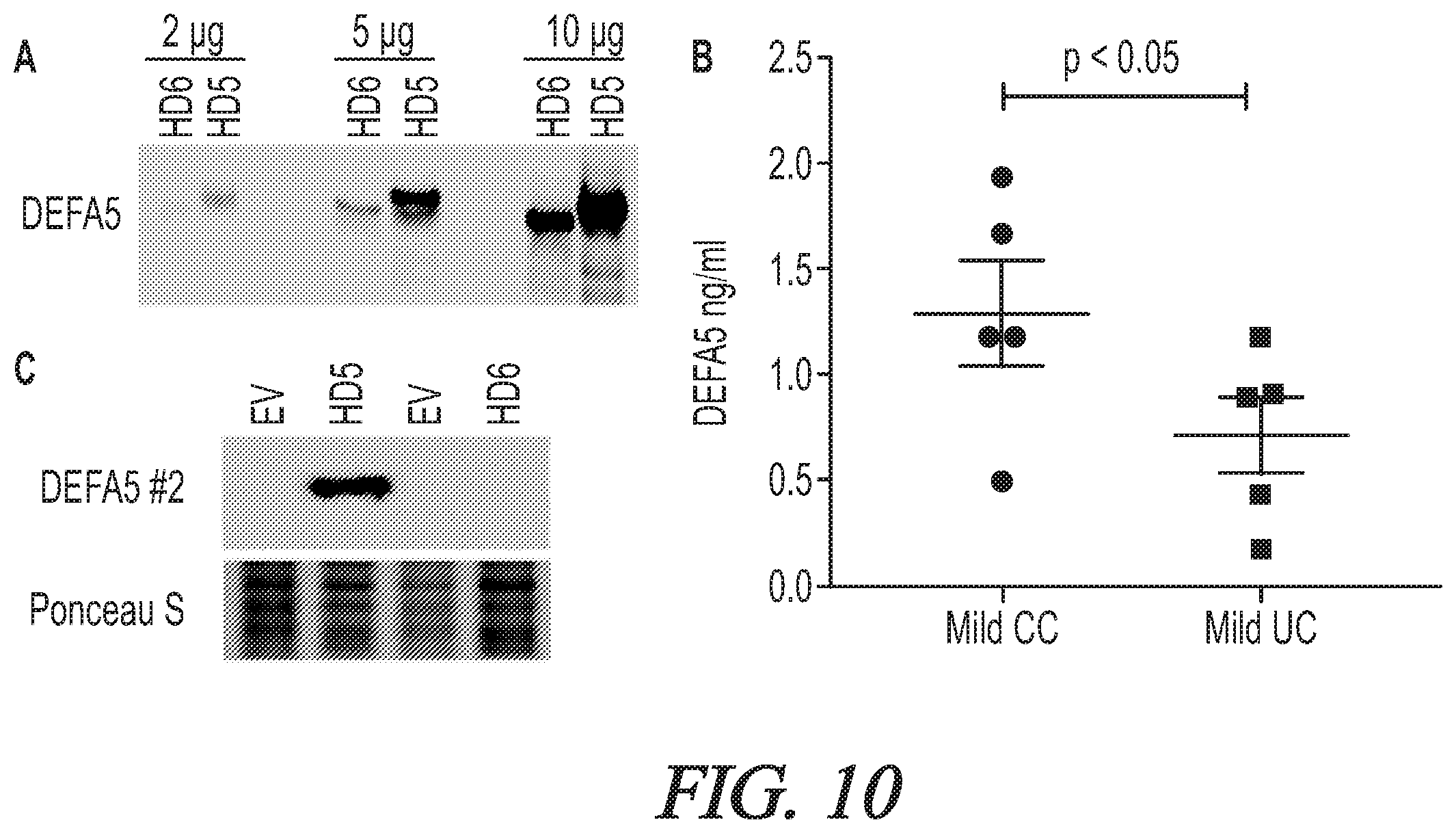Patent US12174200 Figure 10 – Targeted HD5 antibody and assay methods for diagnosing and treating inflammatory bowel disease
